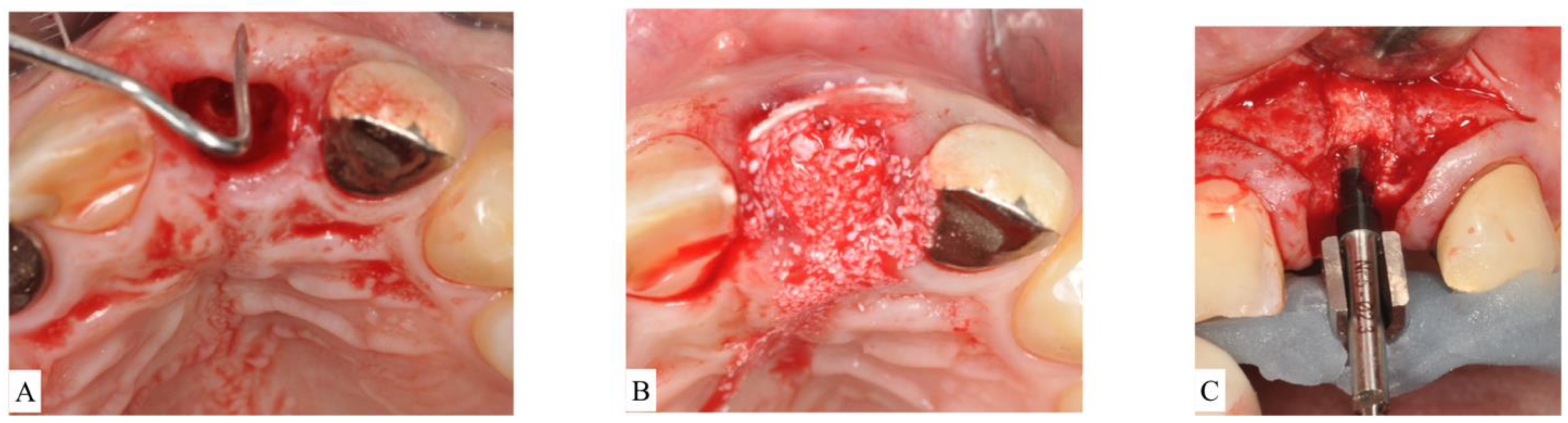 Materials 15 00733 g004
