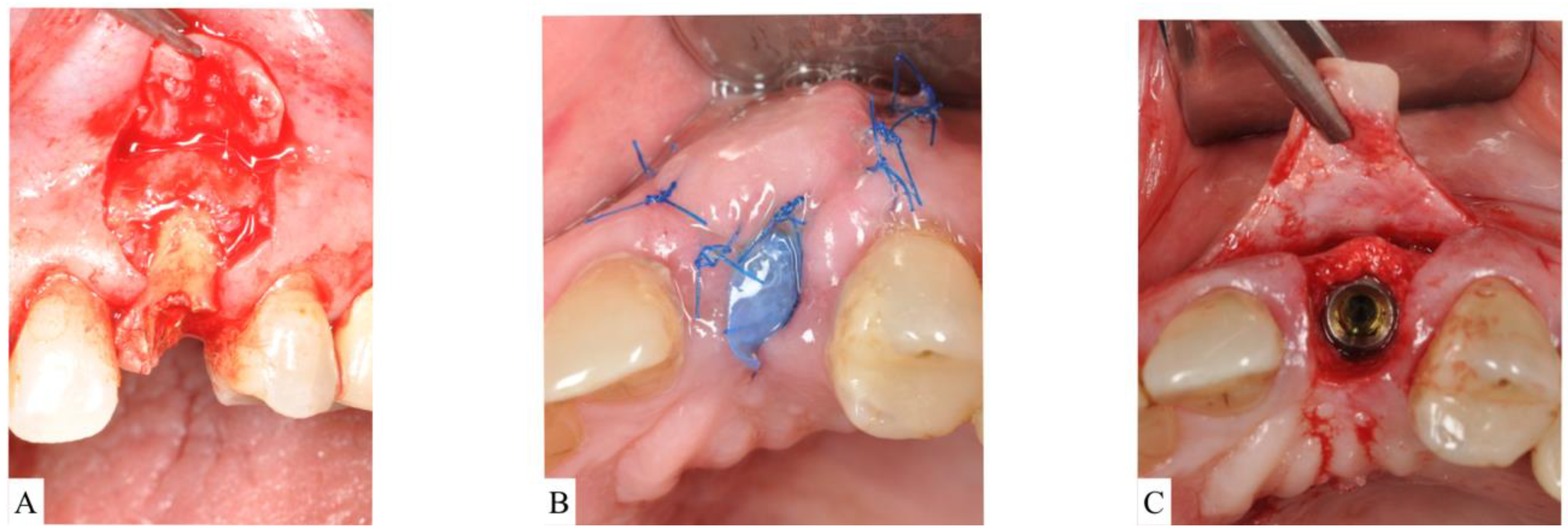 Materials 15 00733 g005