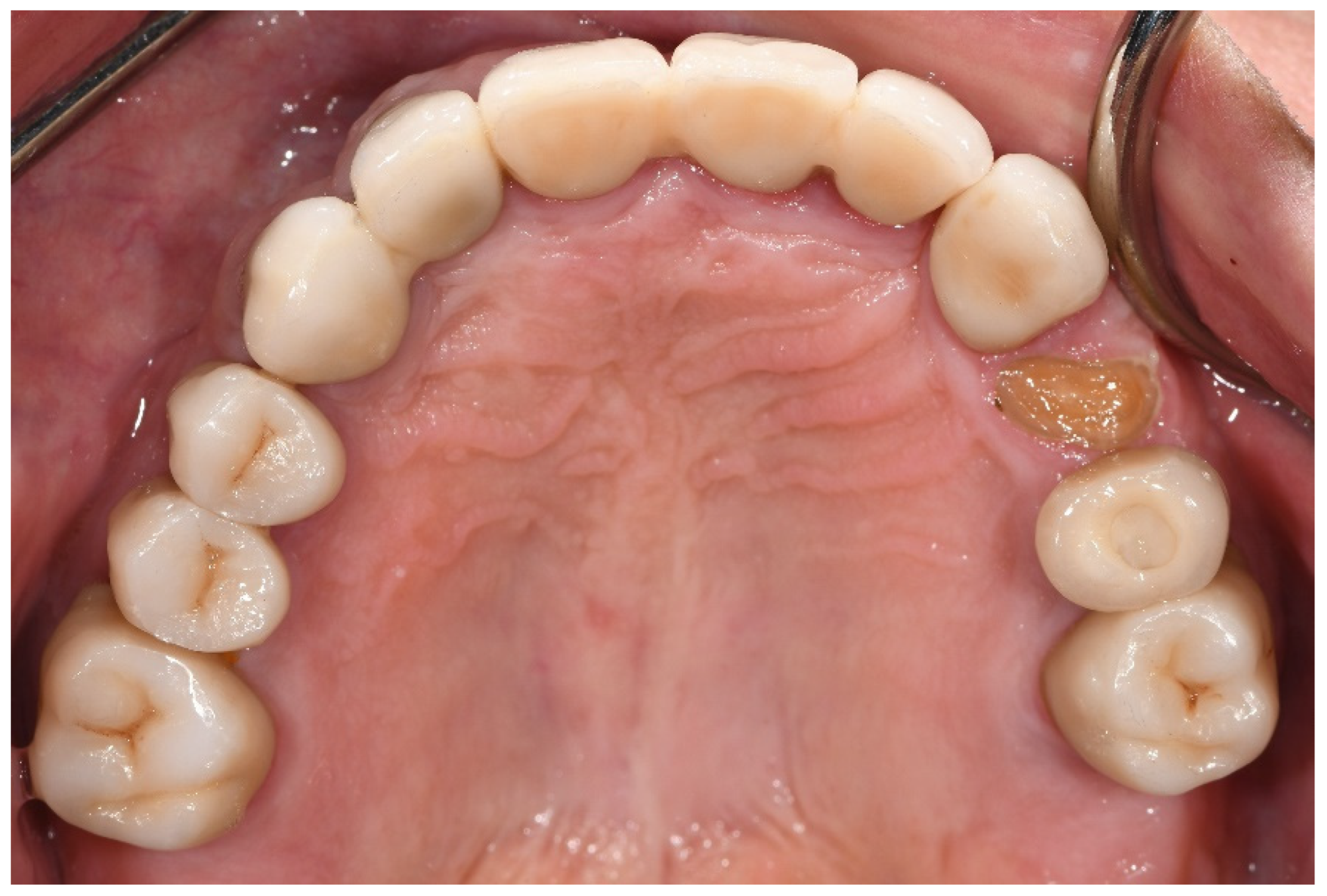 Materials 15 00833 g001