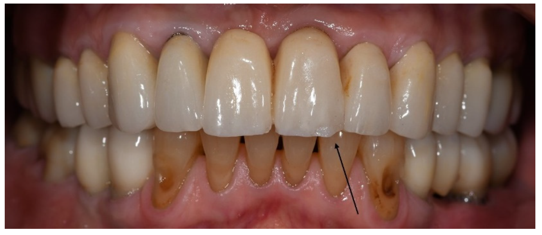 Materials 15 00833 g002