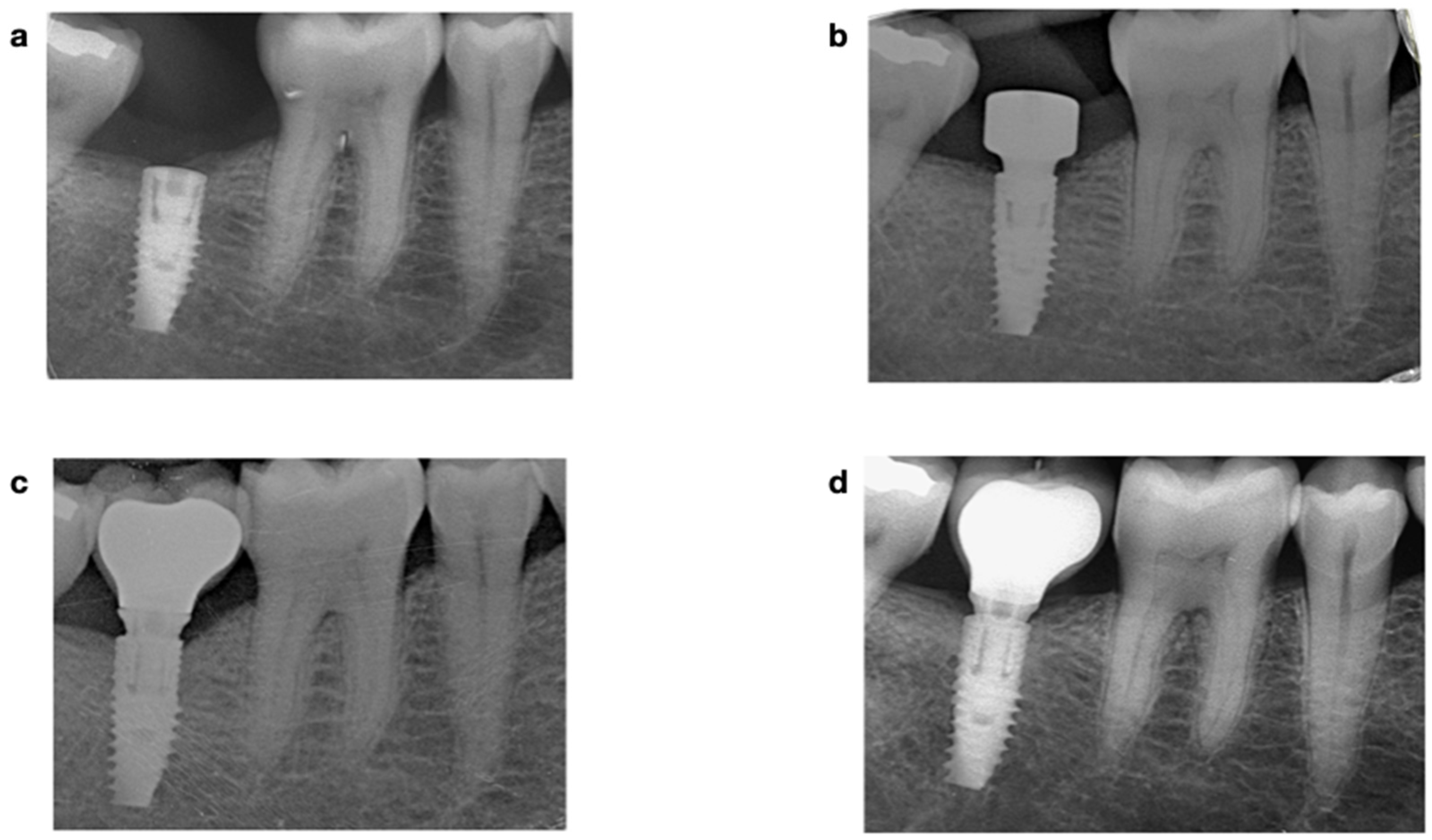 Materials 15 01987 g001