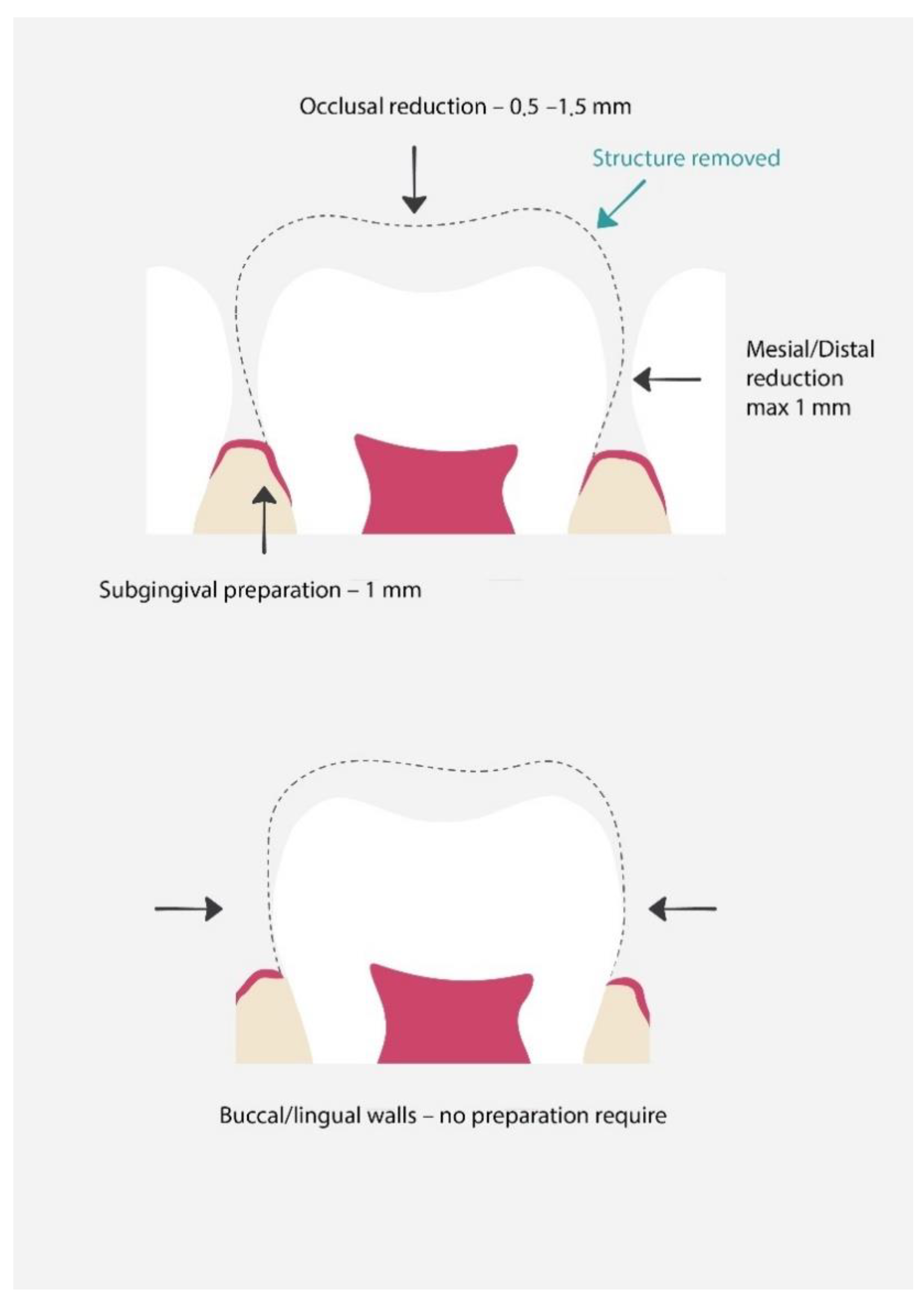 Materials 15 02081 g004