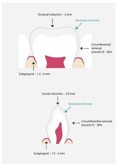 Materials 15 02081 g005 550
