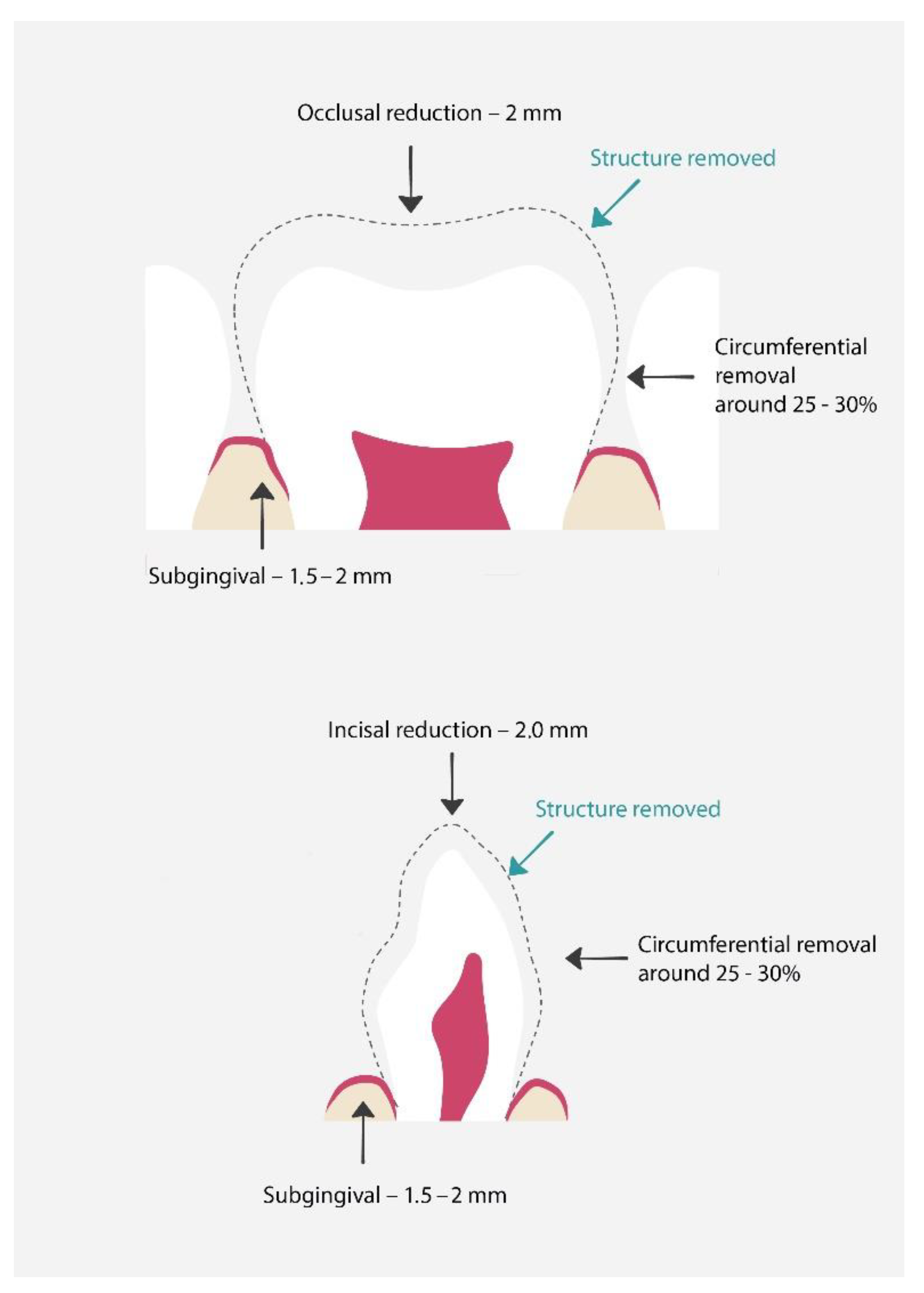 Materials 15 02081 g005