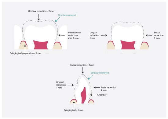 Materials 15 02081 g007 550