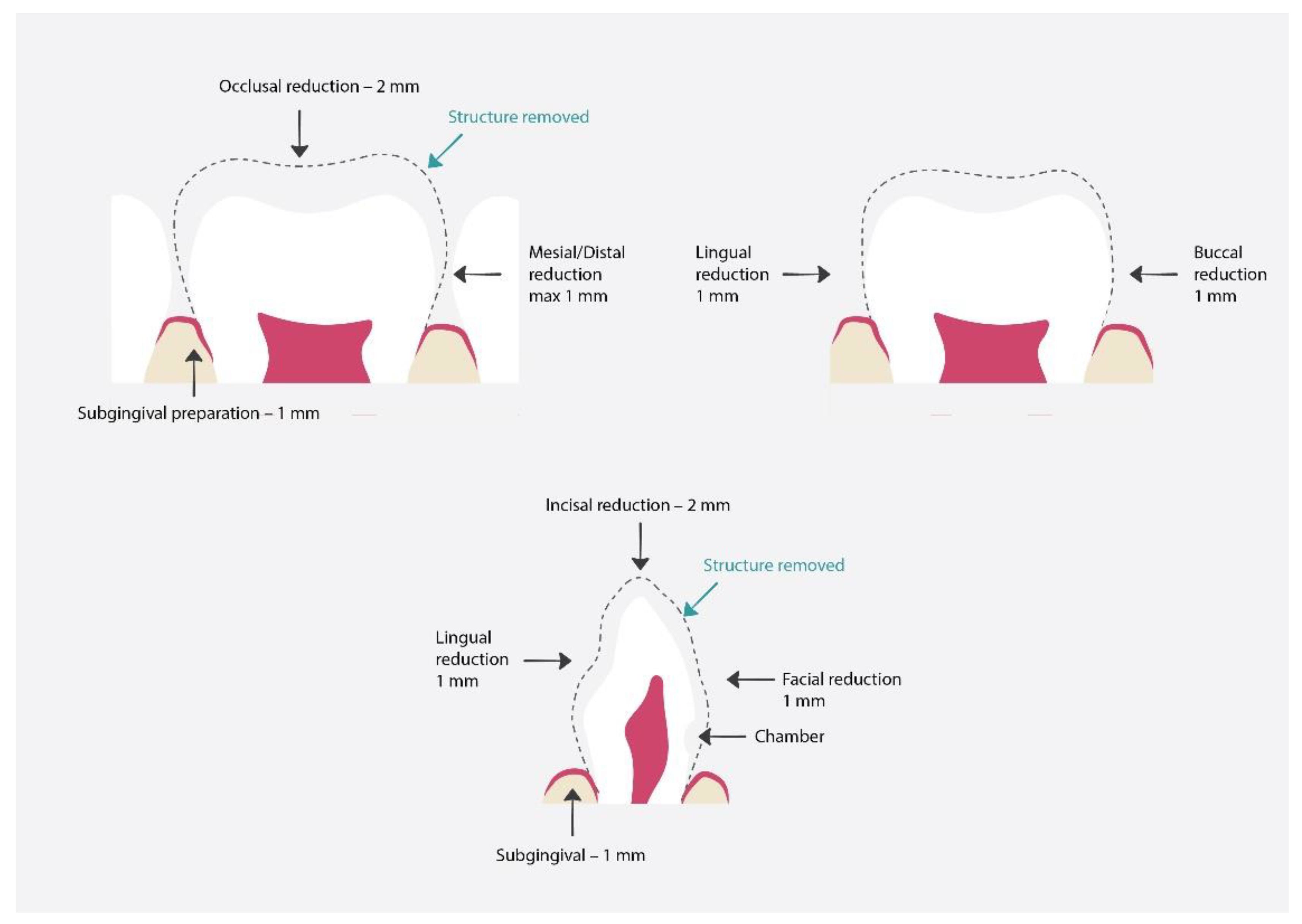Materials 15 02081 g007