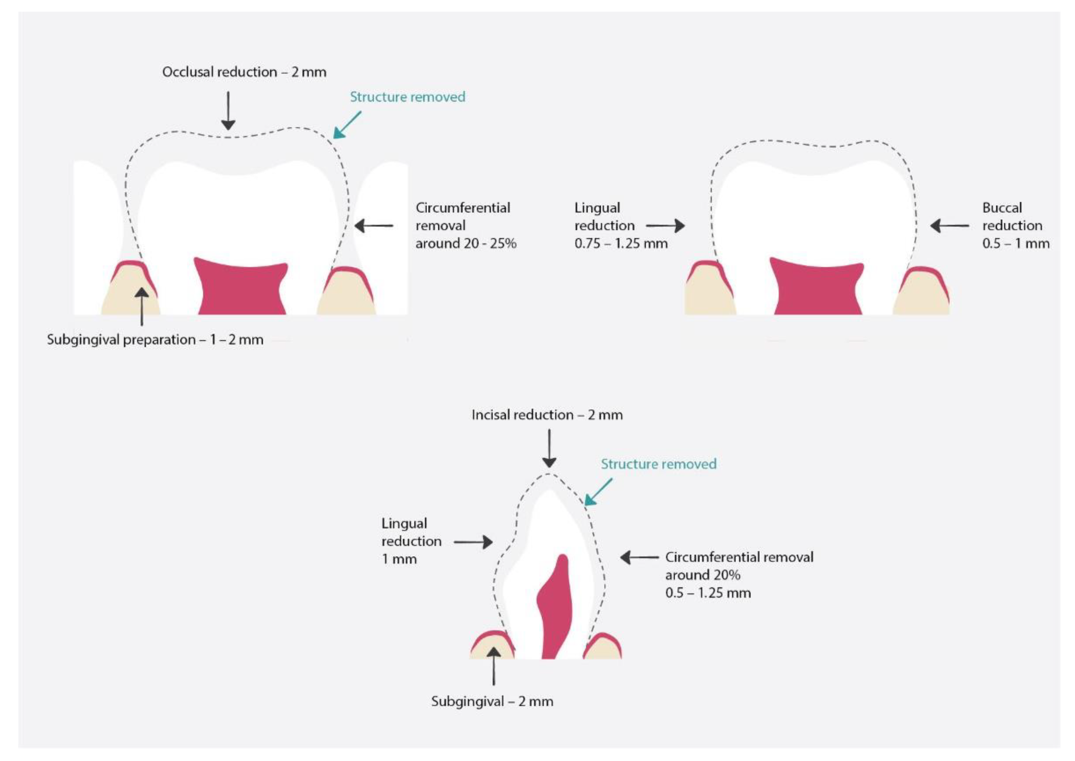 Materials 15 02081 g008