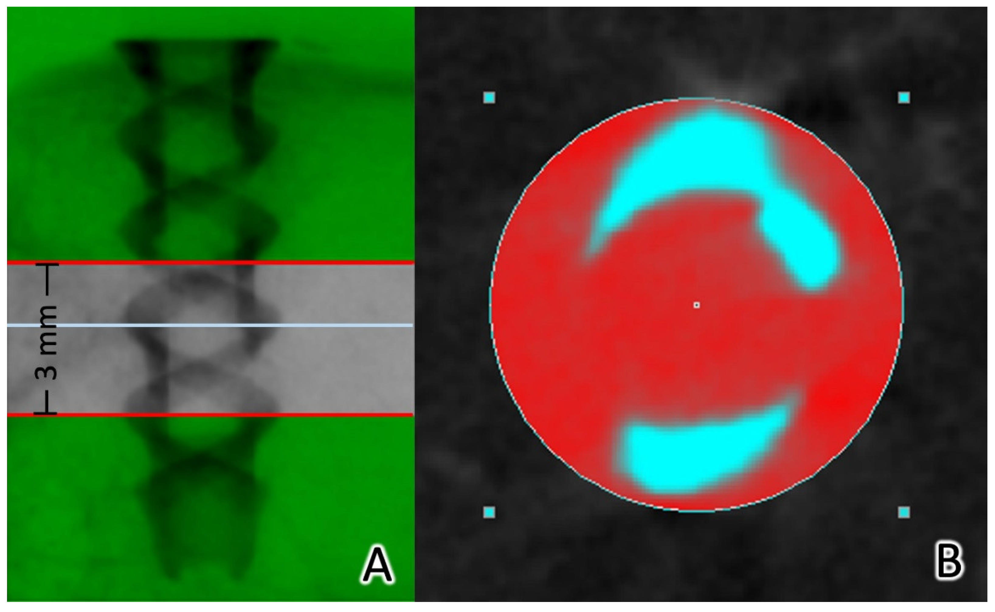 Materials 15 02801 g005