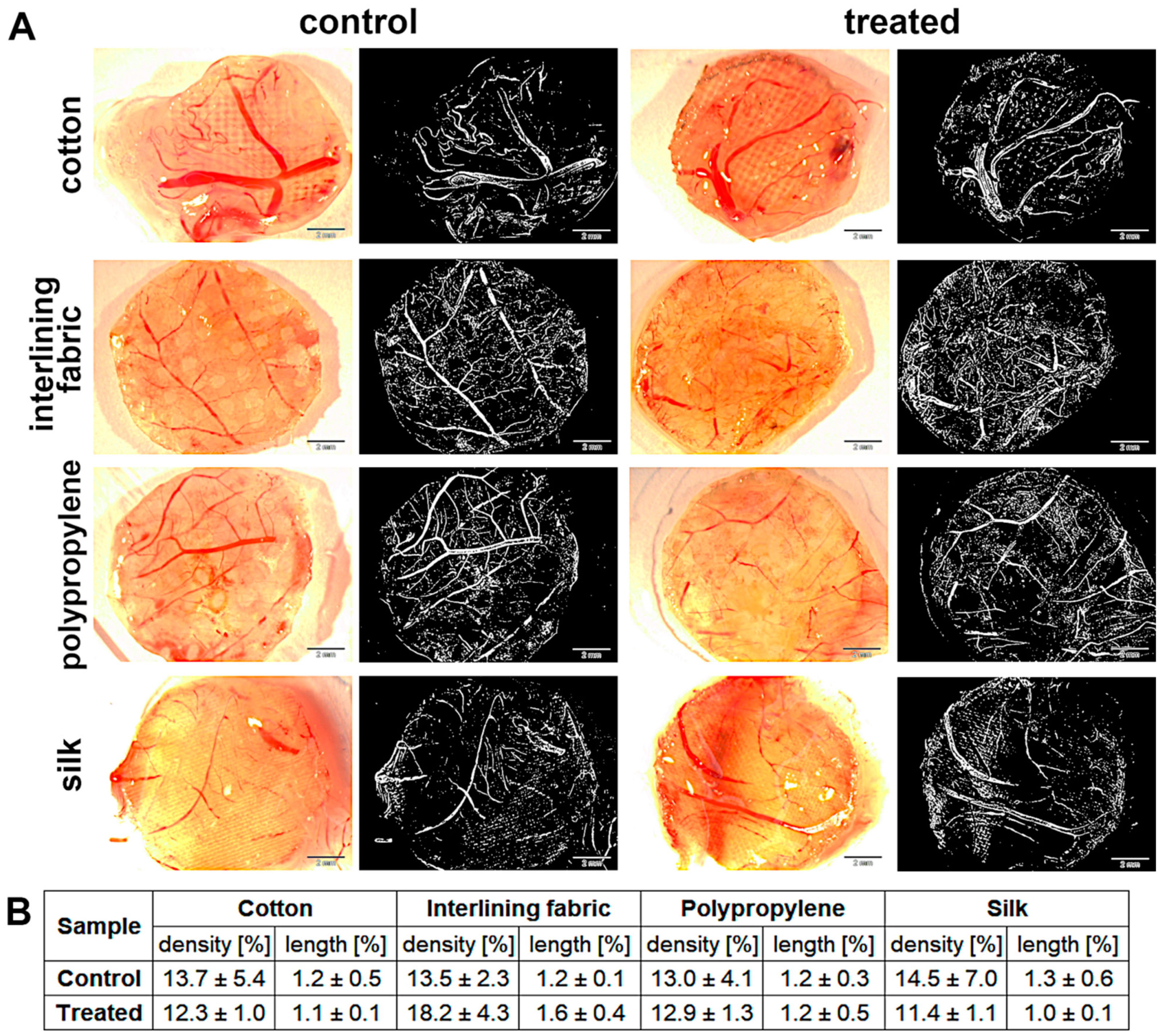 Materials 15 03122 g007