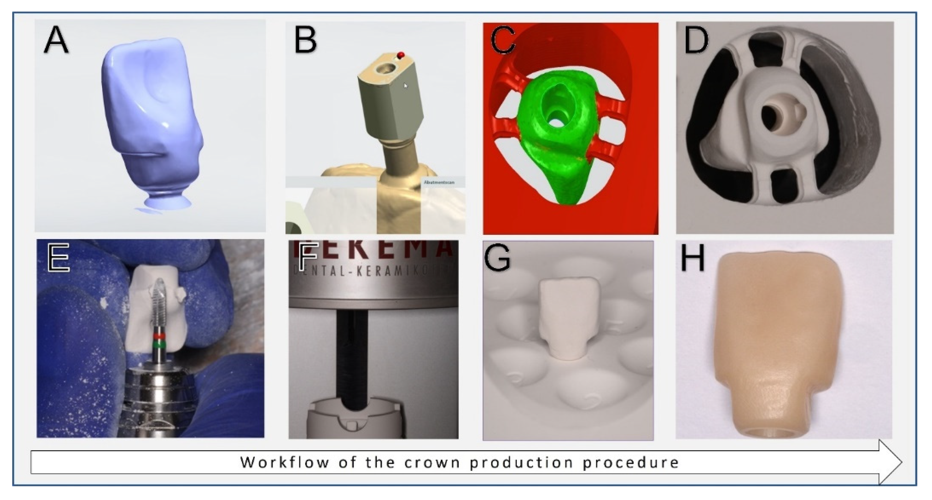 Materials 15 03381 g003