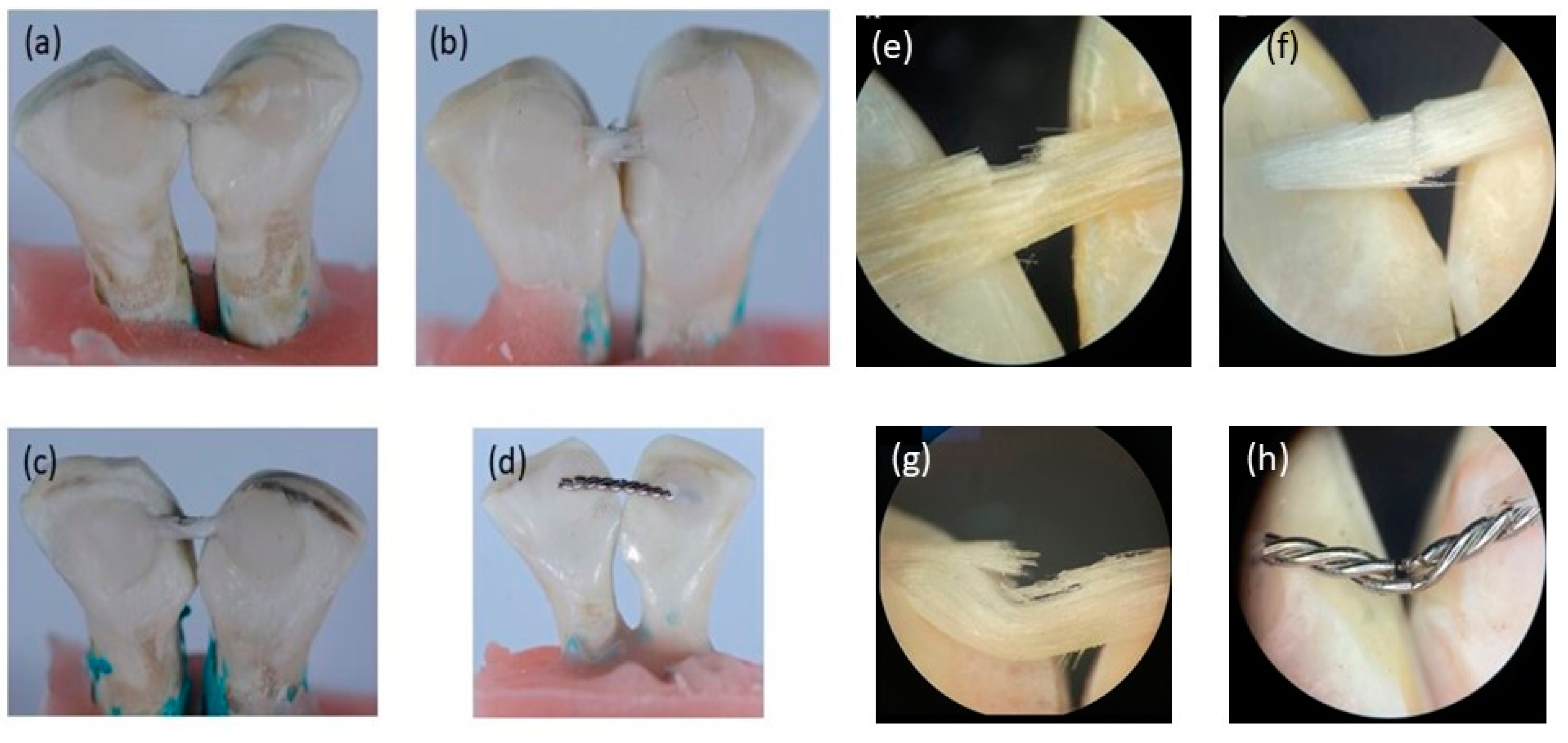 Materials 15 03504 g004