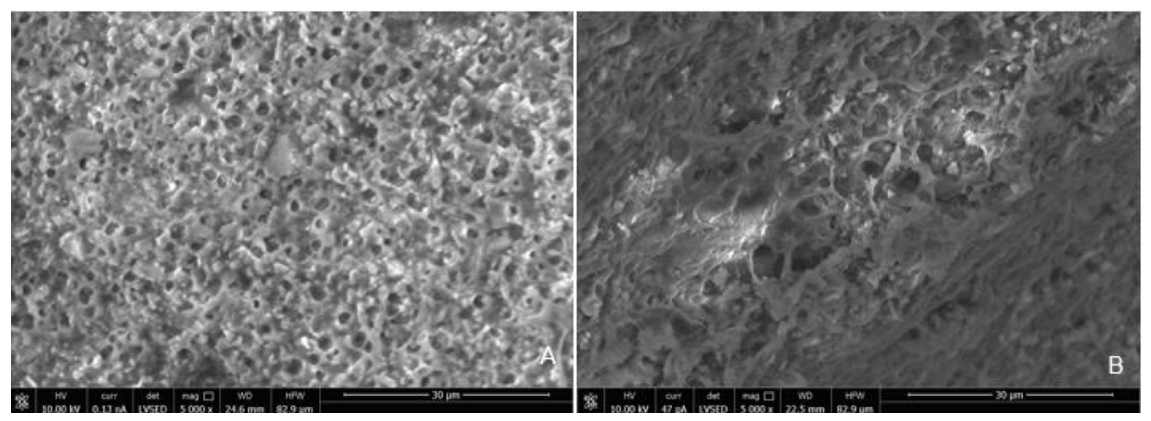 Materials 15 03617 g006