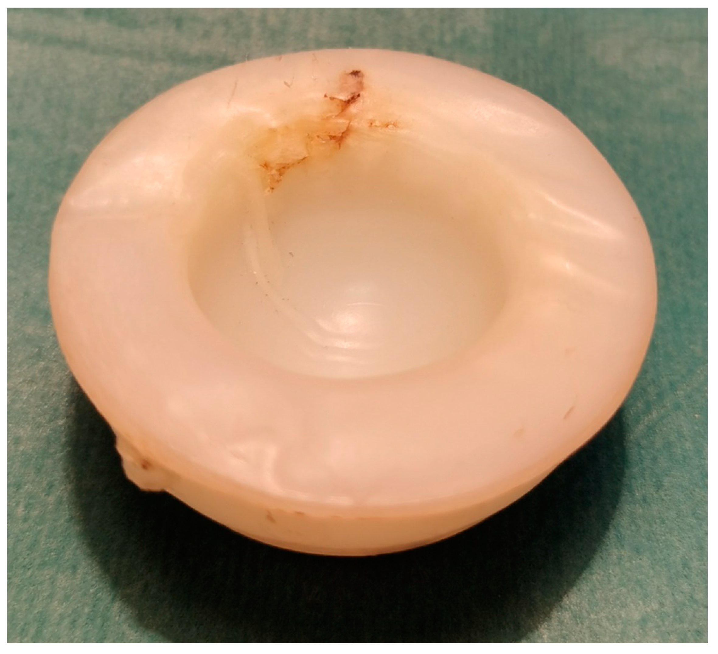 Materials 15 03622 g003