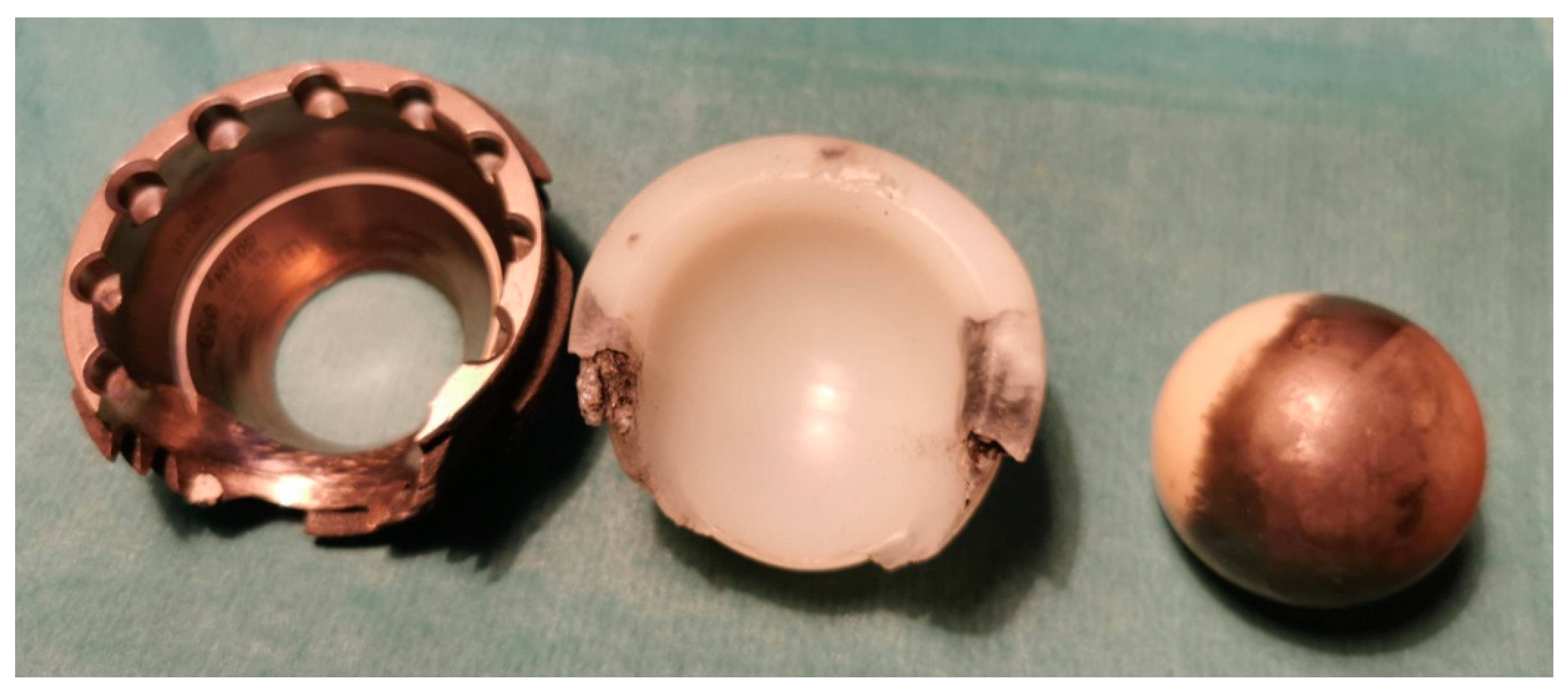 Materials 15 03622 g005a