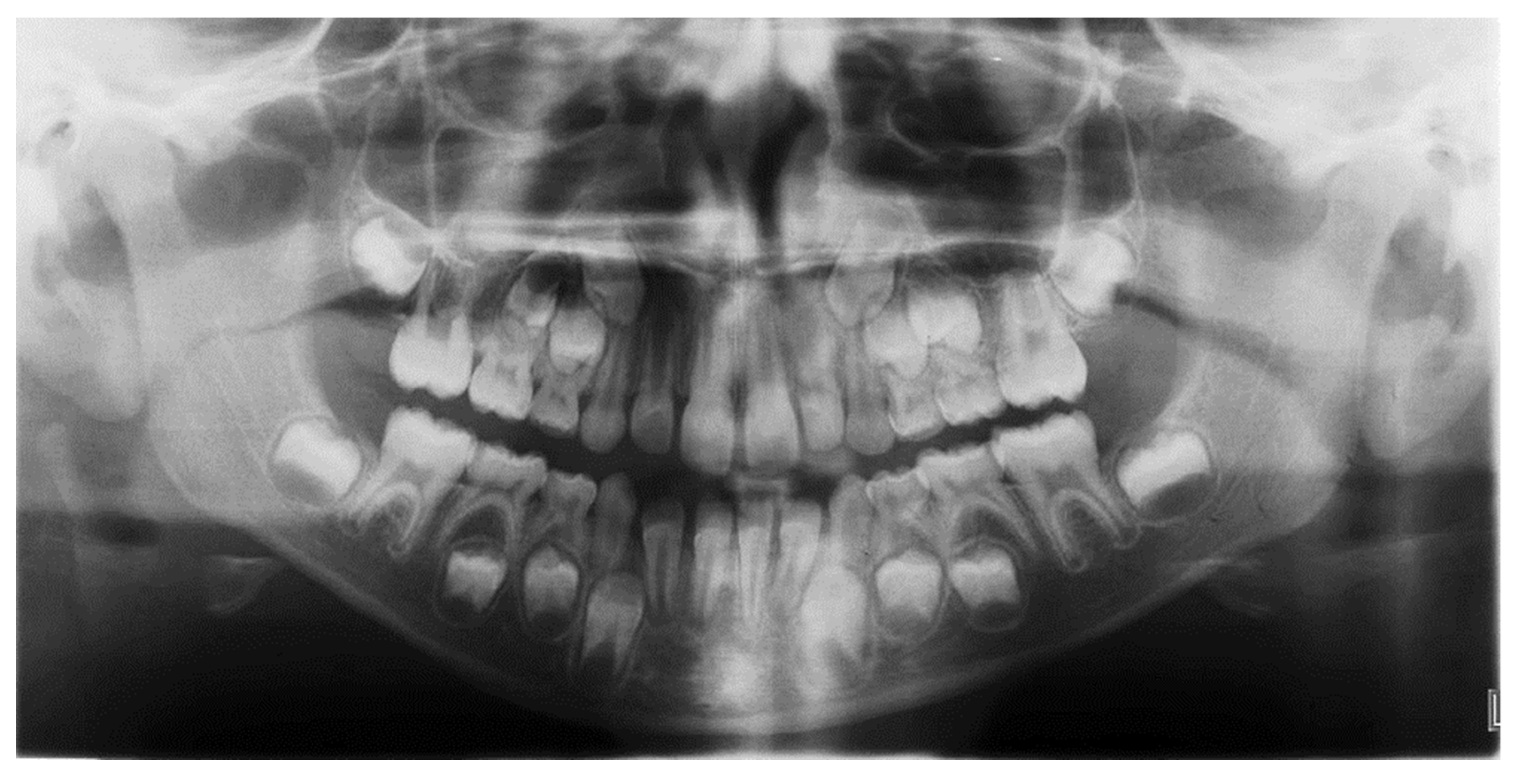 Materials 15 03747 g002