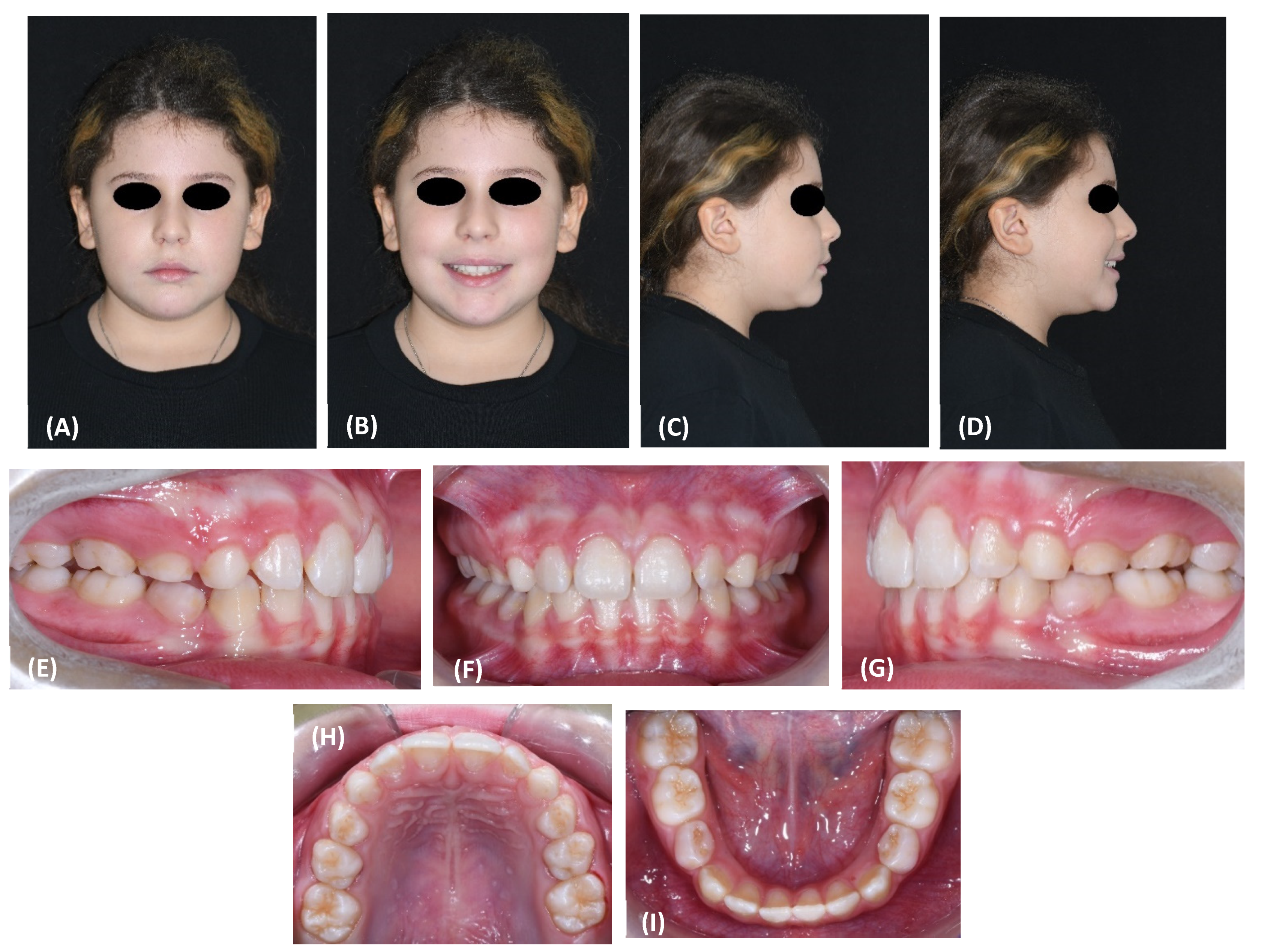 Materials 15 03747 g007