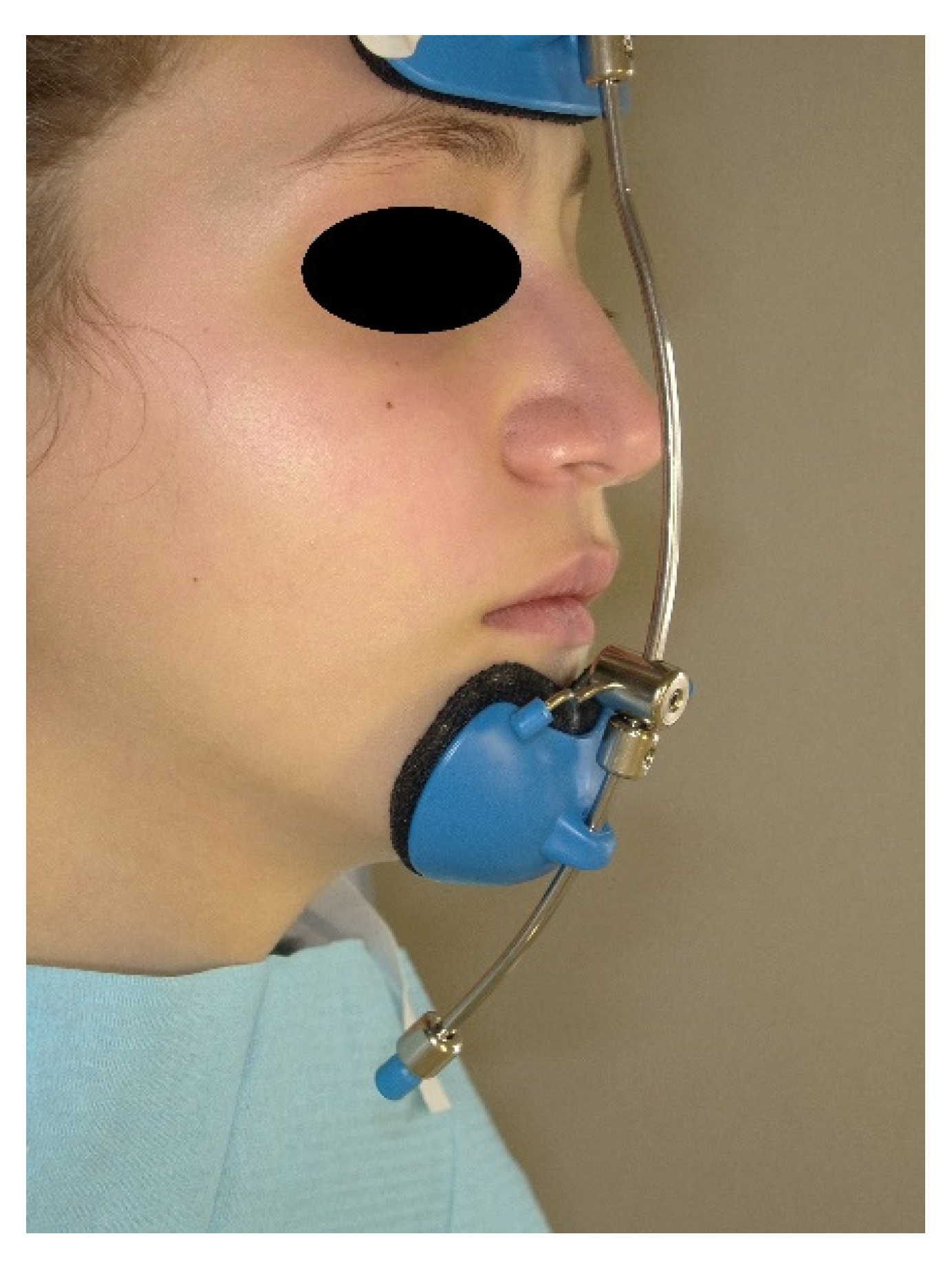 Materials 15 03747 g009