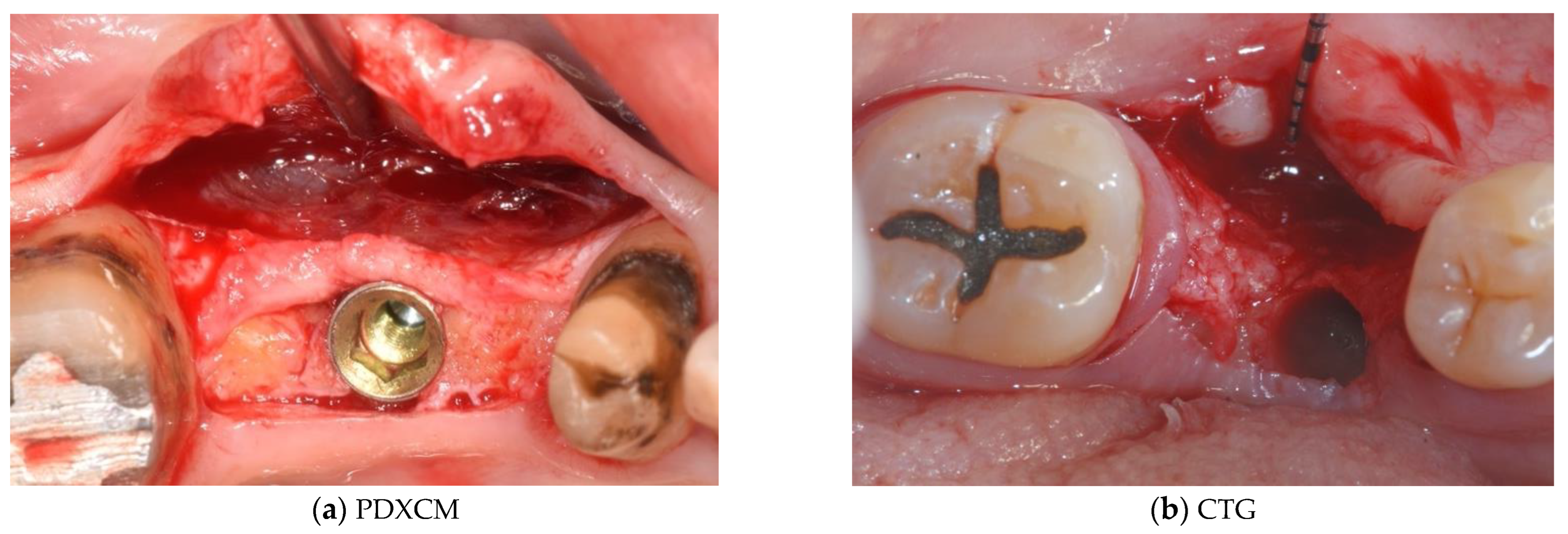 Materials 15 03937 g002