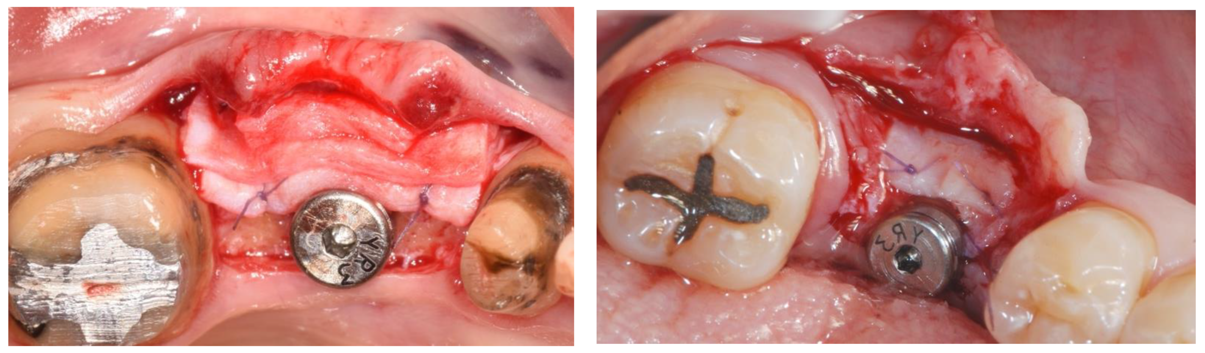 Materials 15 03937 g004