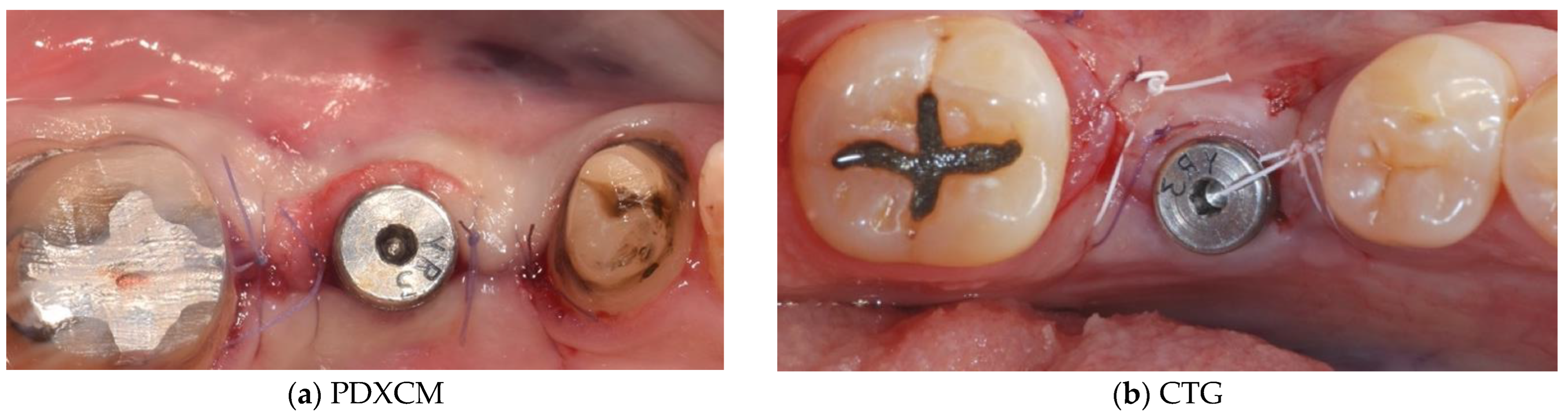 Materials 15 03937 g005