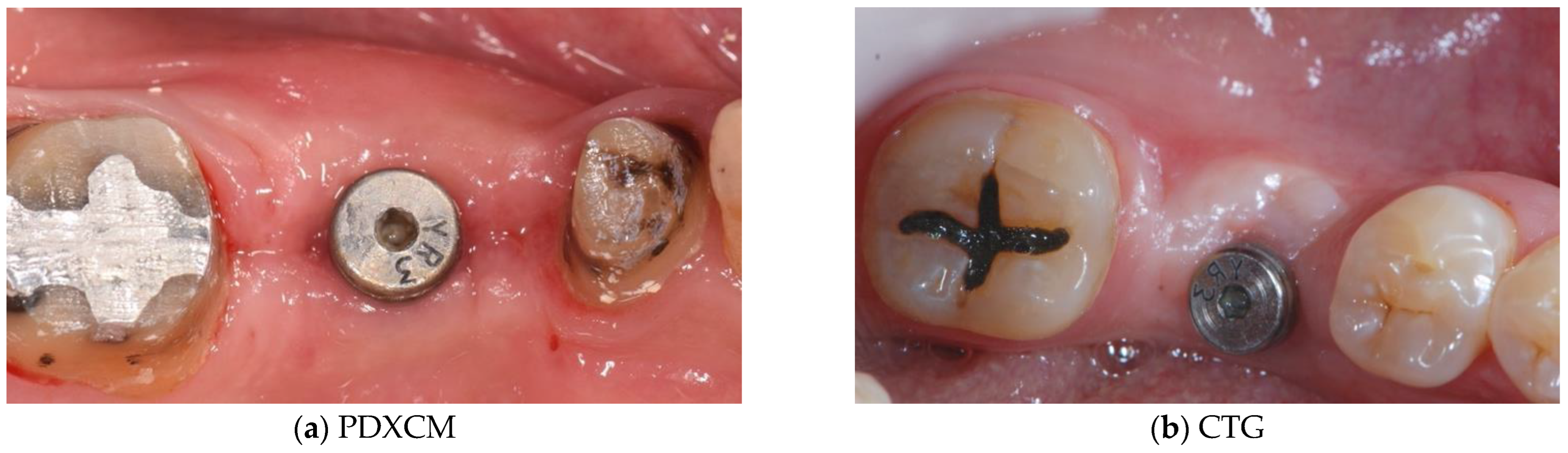 Materials 15 03937 g006