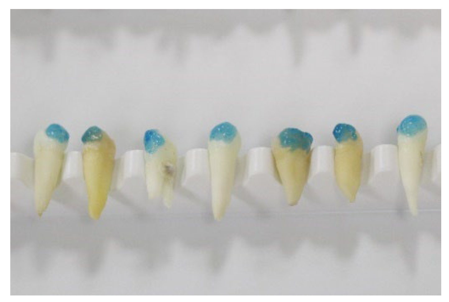 Materials 15 04304 g001