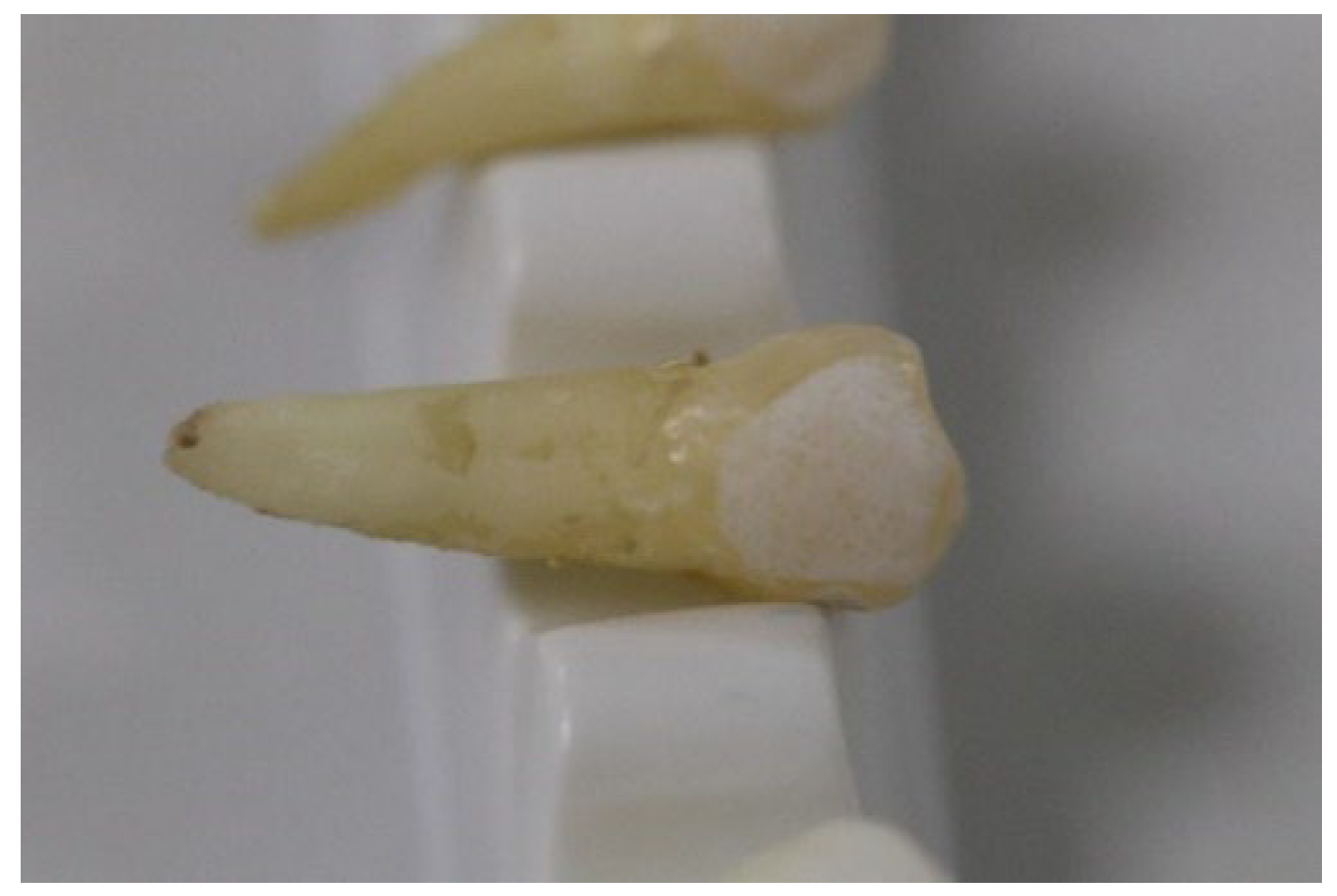 Materials 15 04304 g002