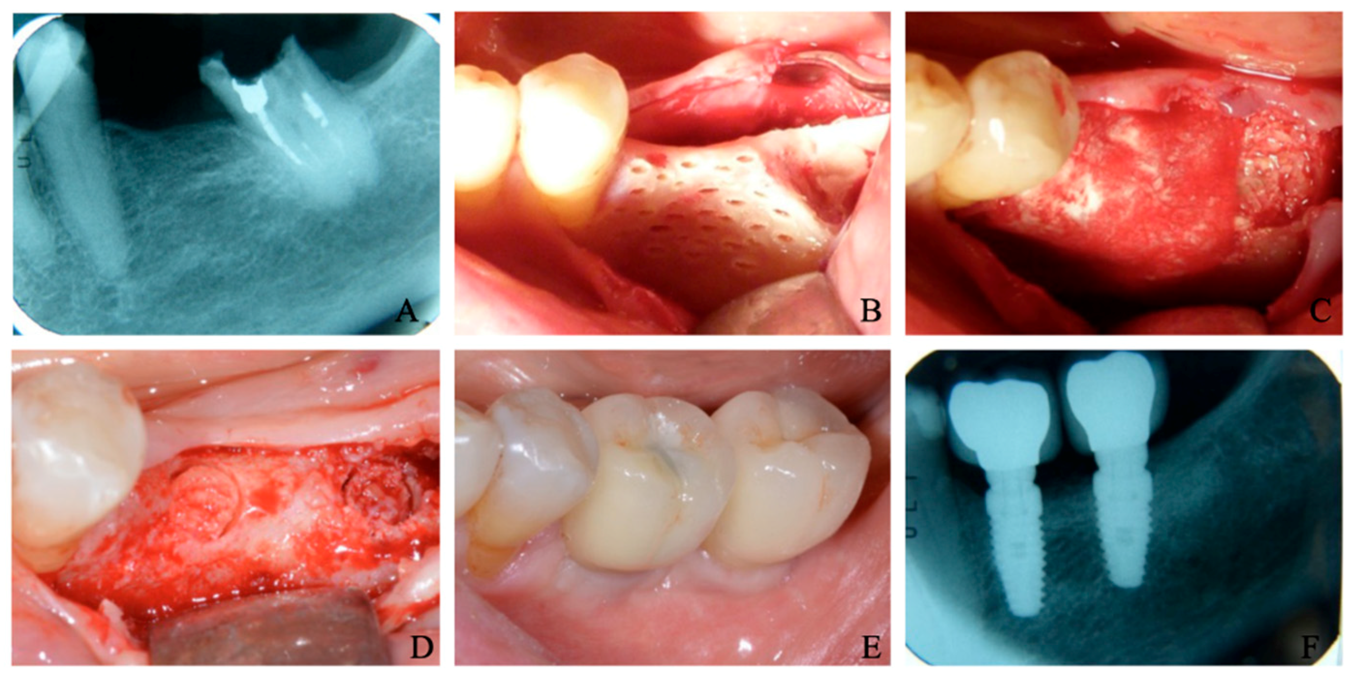 Materials 15 04319 g004