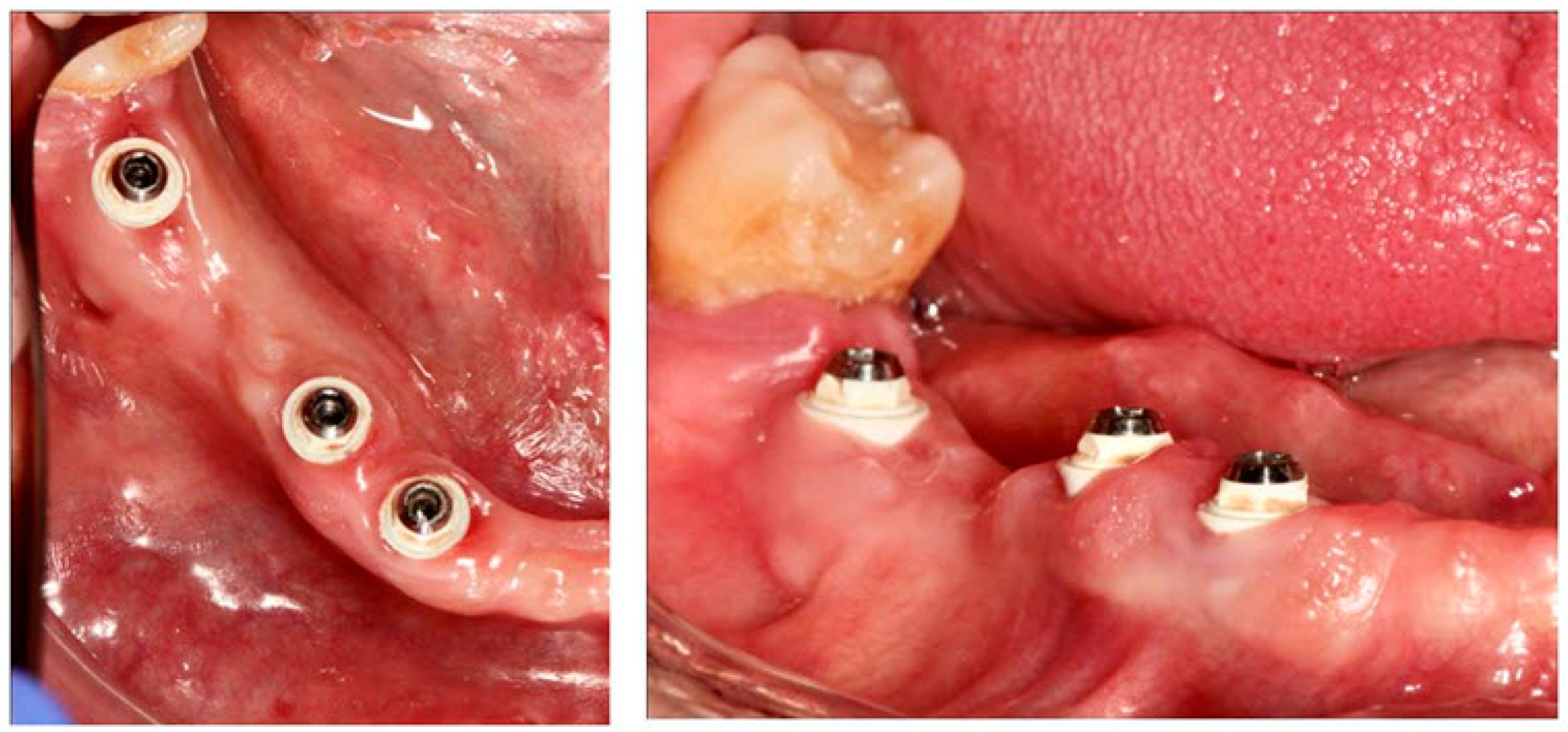 Materials 15 05422 g007