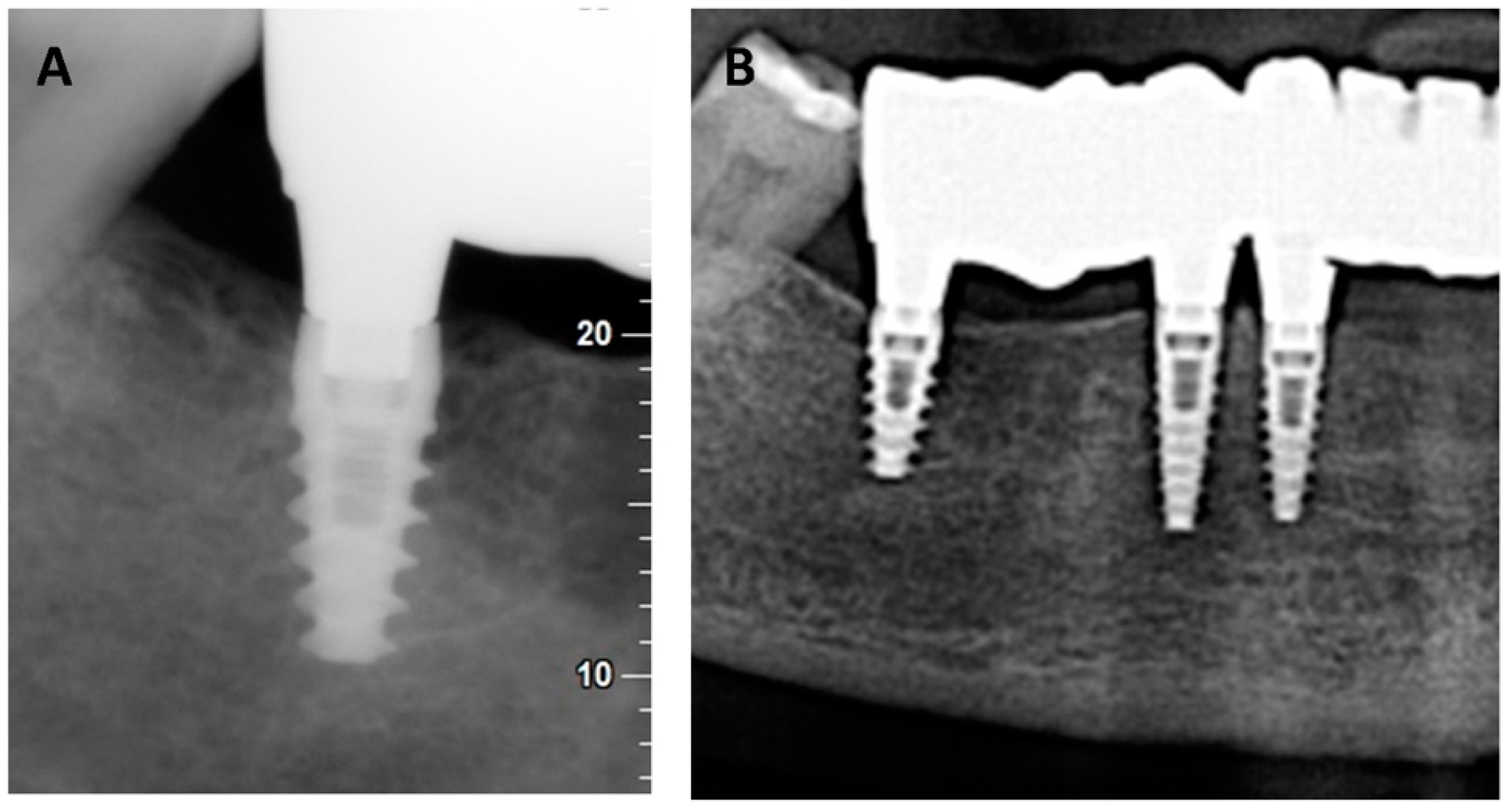 Materials 15 05422 g008