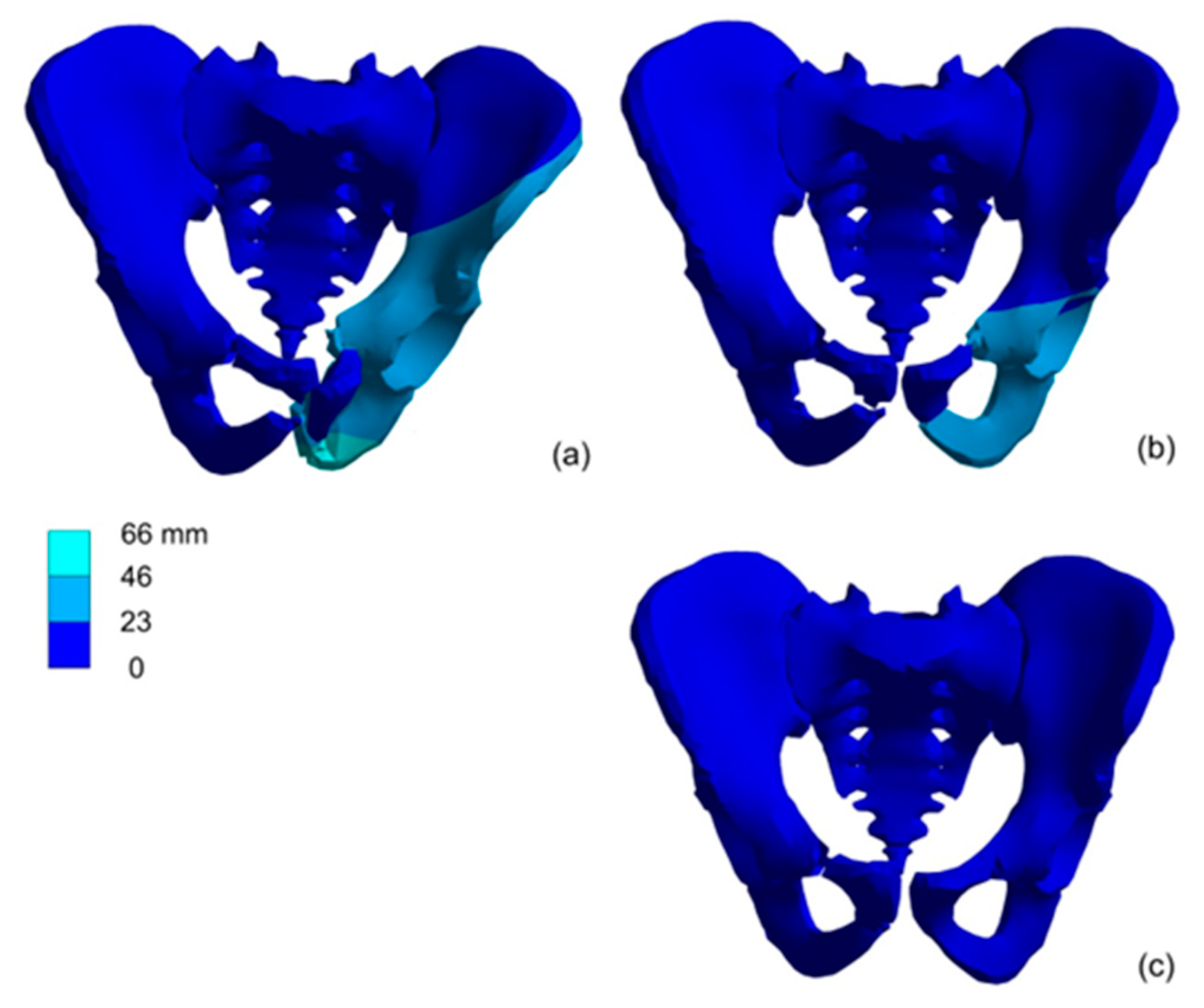 Materials 15 05734 g007