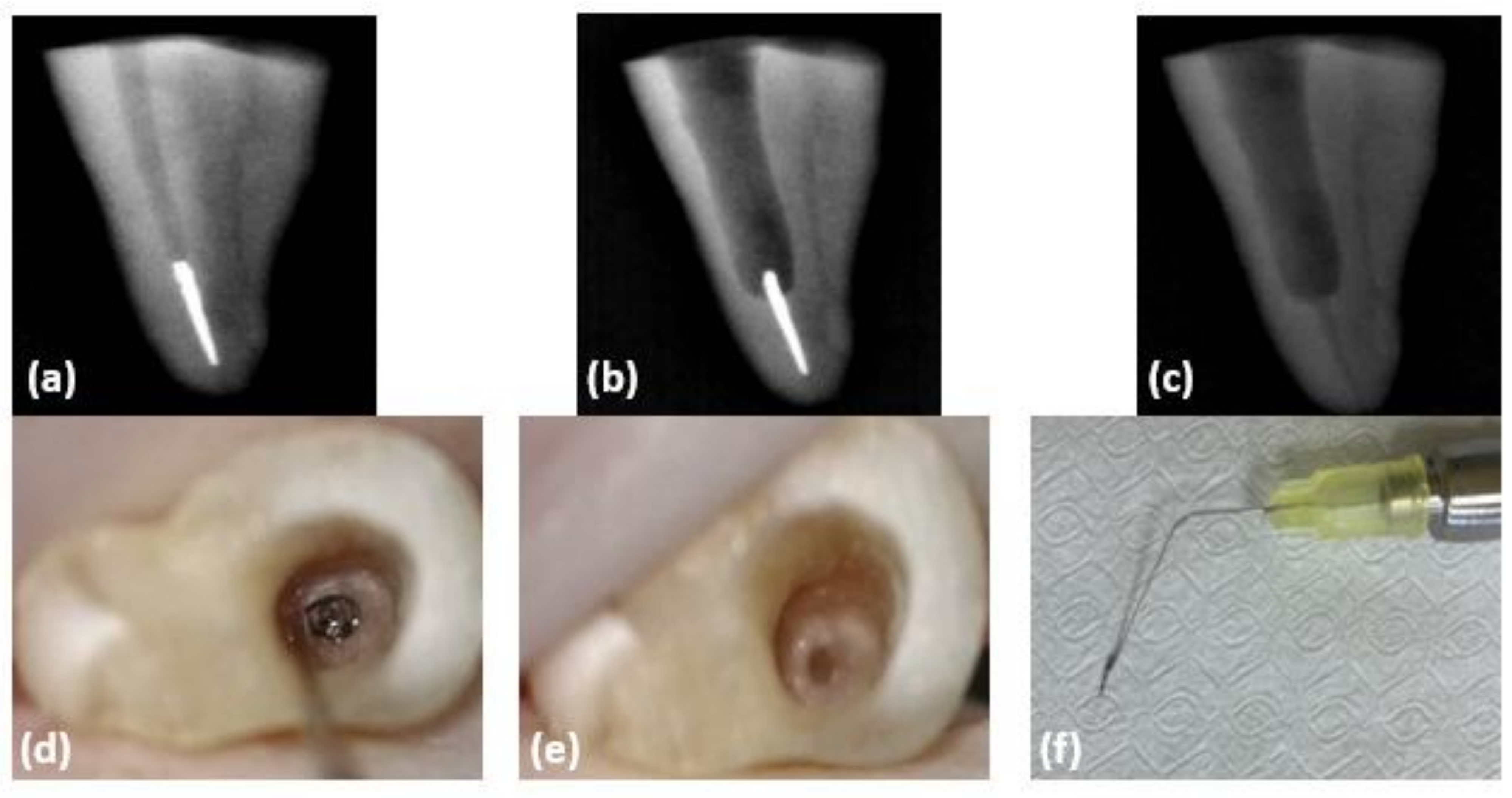 Materials 15 05816 g001