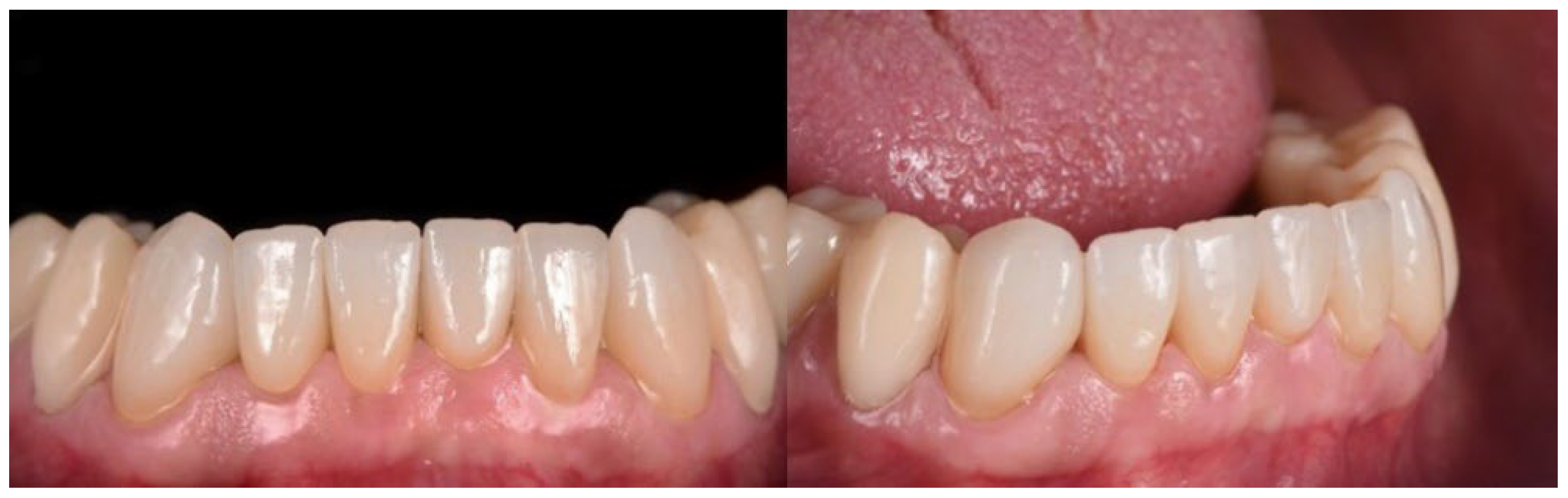 Materials 15 06034 g003