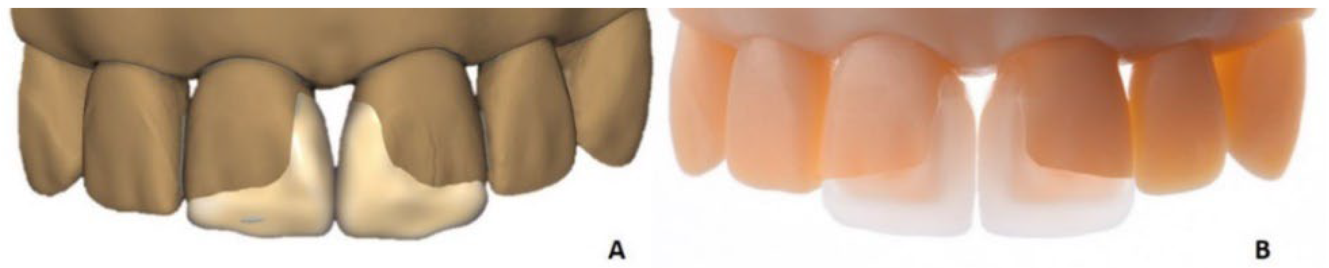 Materials 15 06034 g005