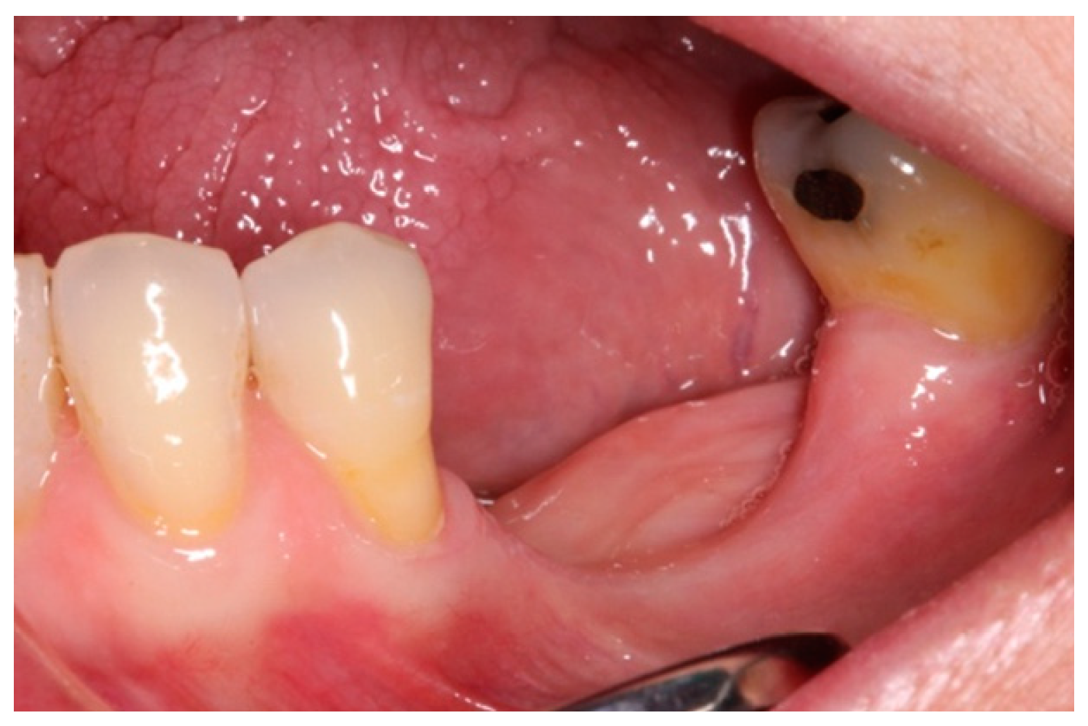 Materials 15 06271 g001