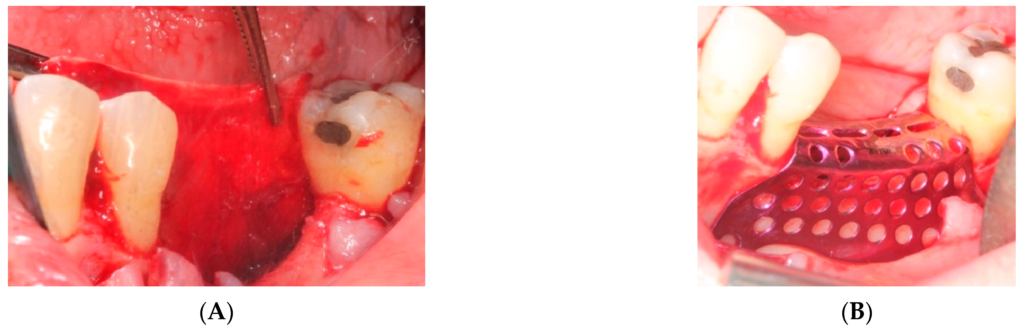 Materials 15 06271 g003