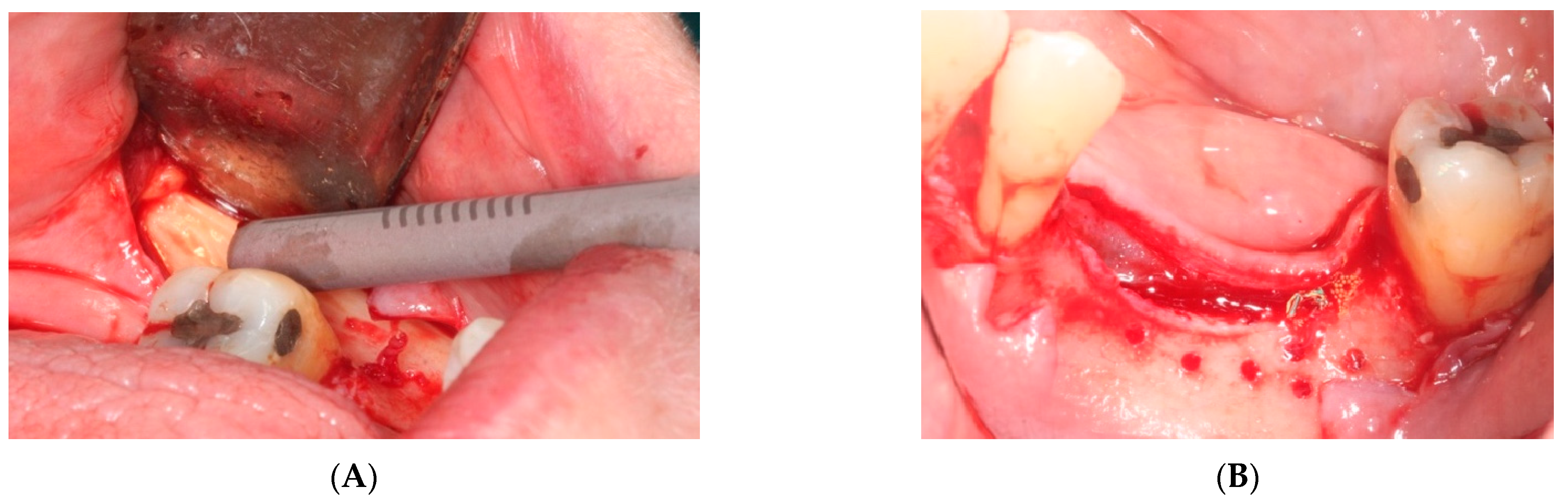 Materials 15 06271 g004