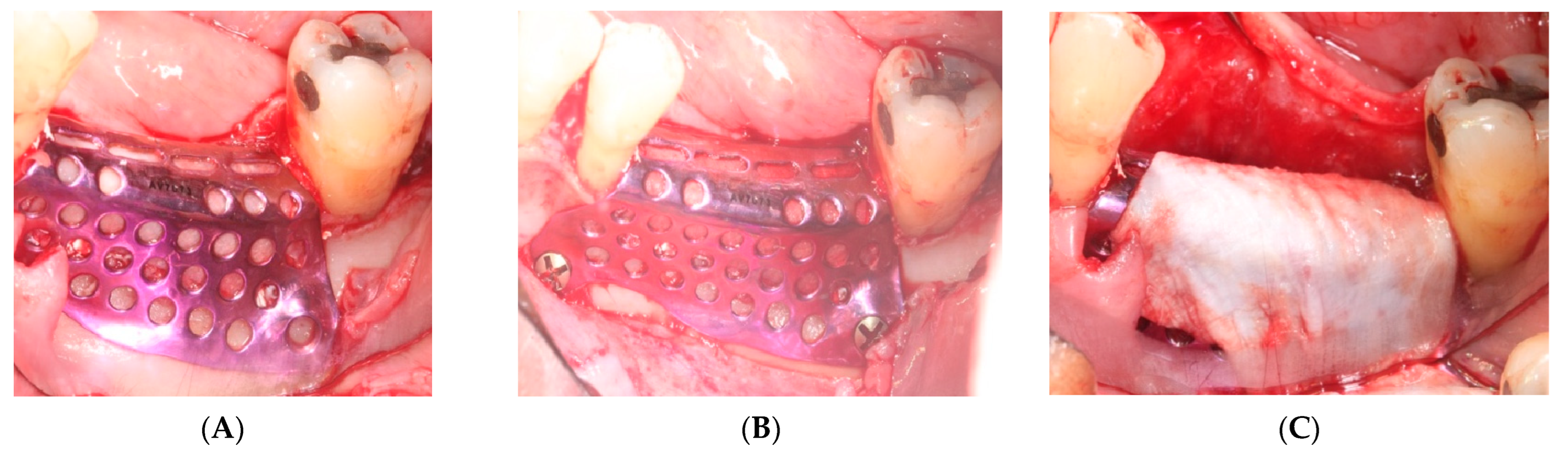 Materials 15 06271 g005