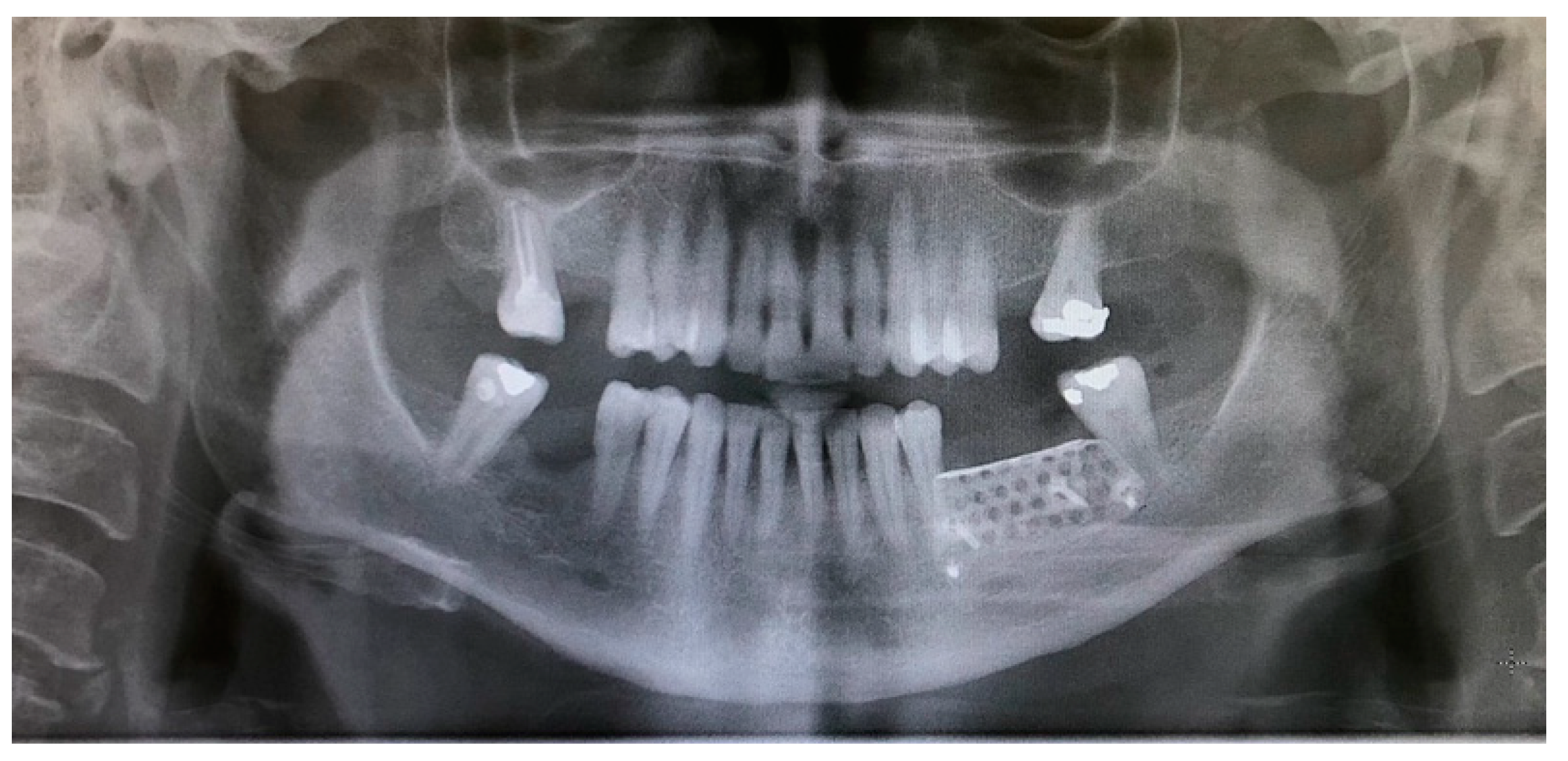 Materials 15 06271 g007