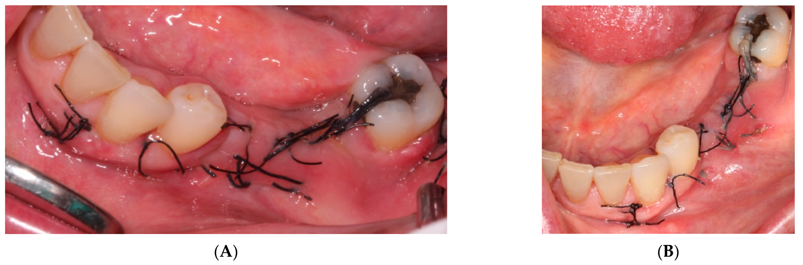 Materials 15 06271 g008