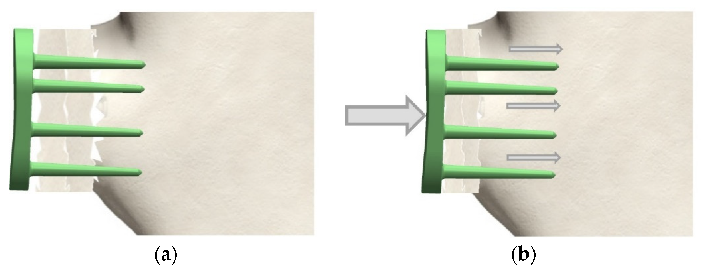 Materials 15 06457 g004