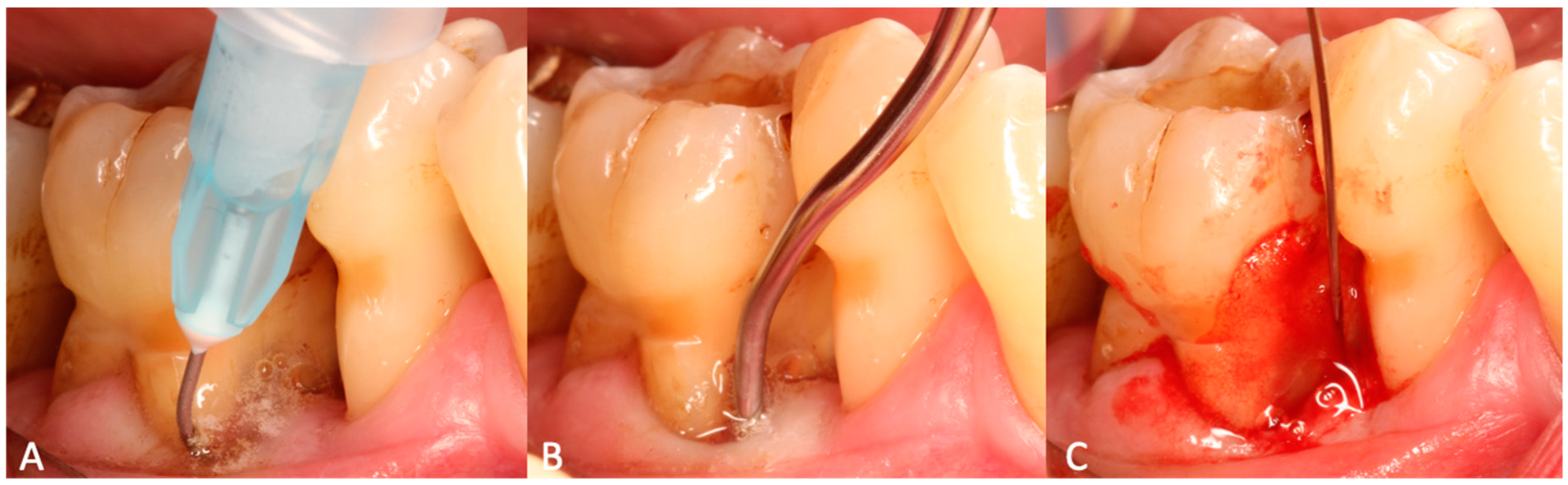 Materials 15 06508 g001