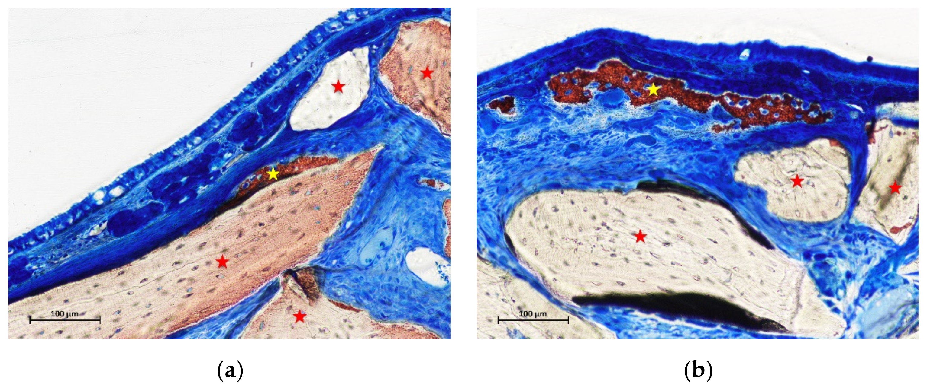 Materials 15 08077 g004 Materials 15 08077 g004