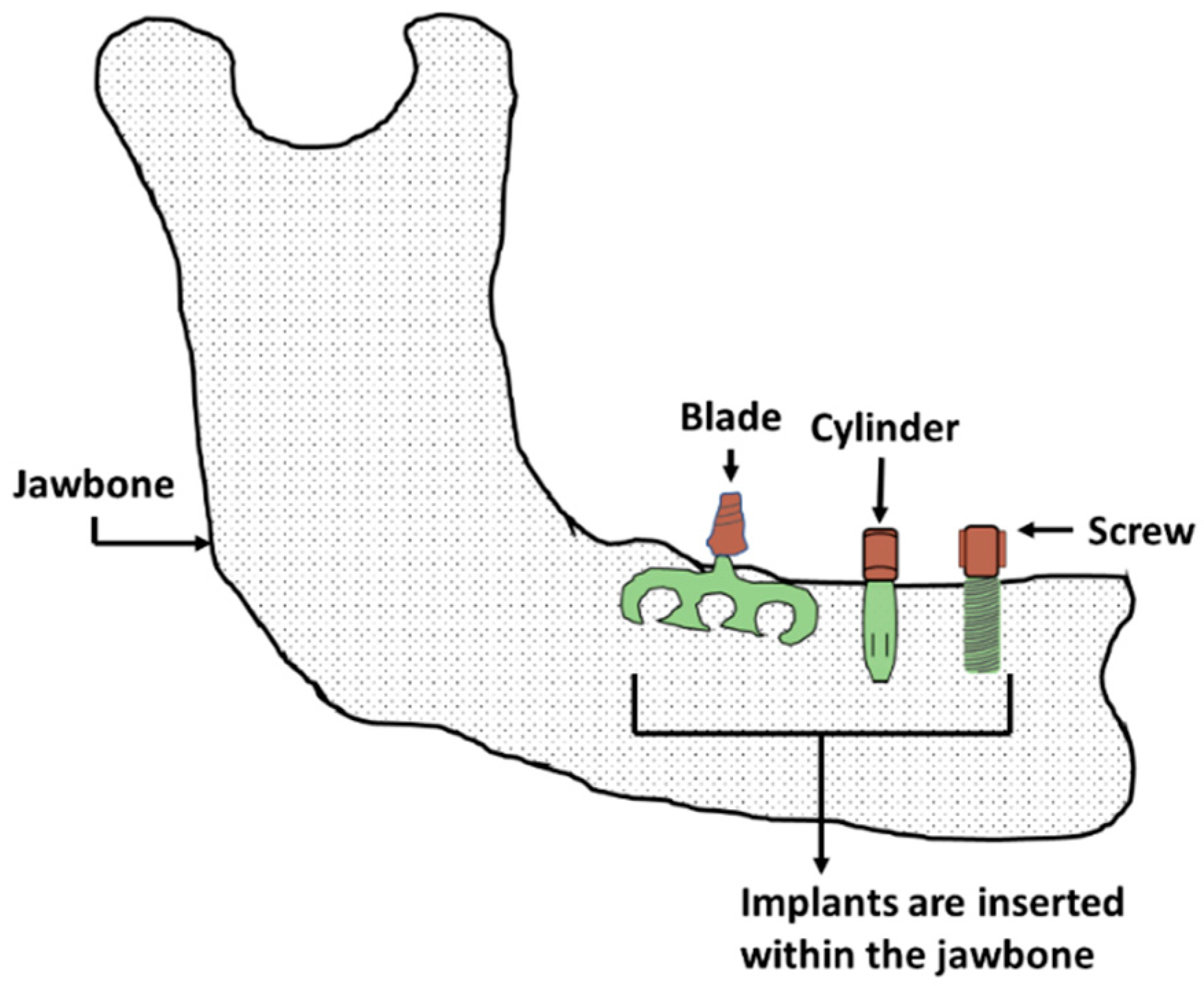 Materials 16 00161 g004