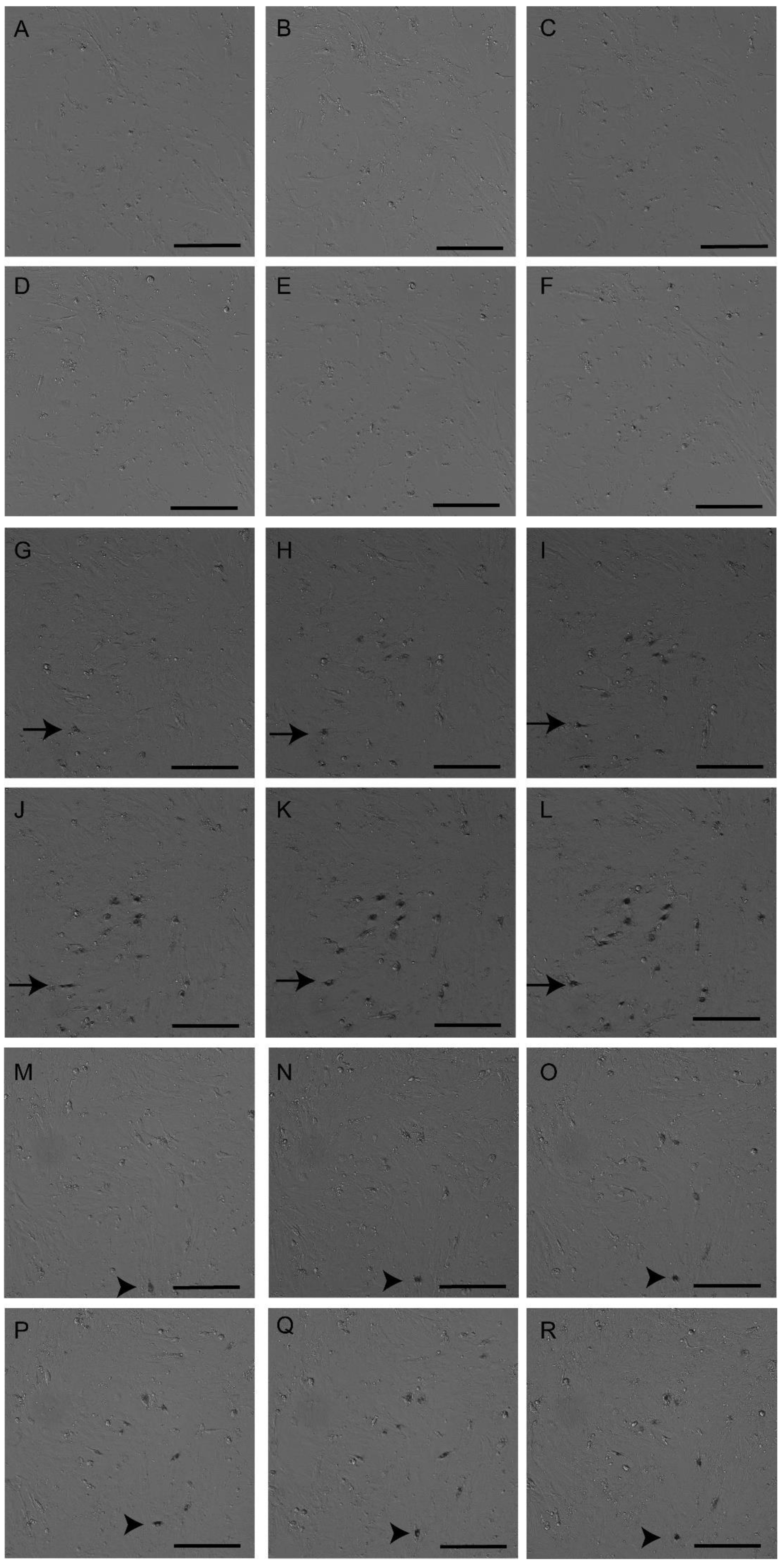 Materials 16 01034 g005 Materials 16 01034 g005