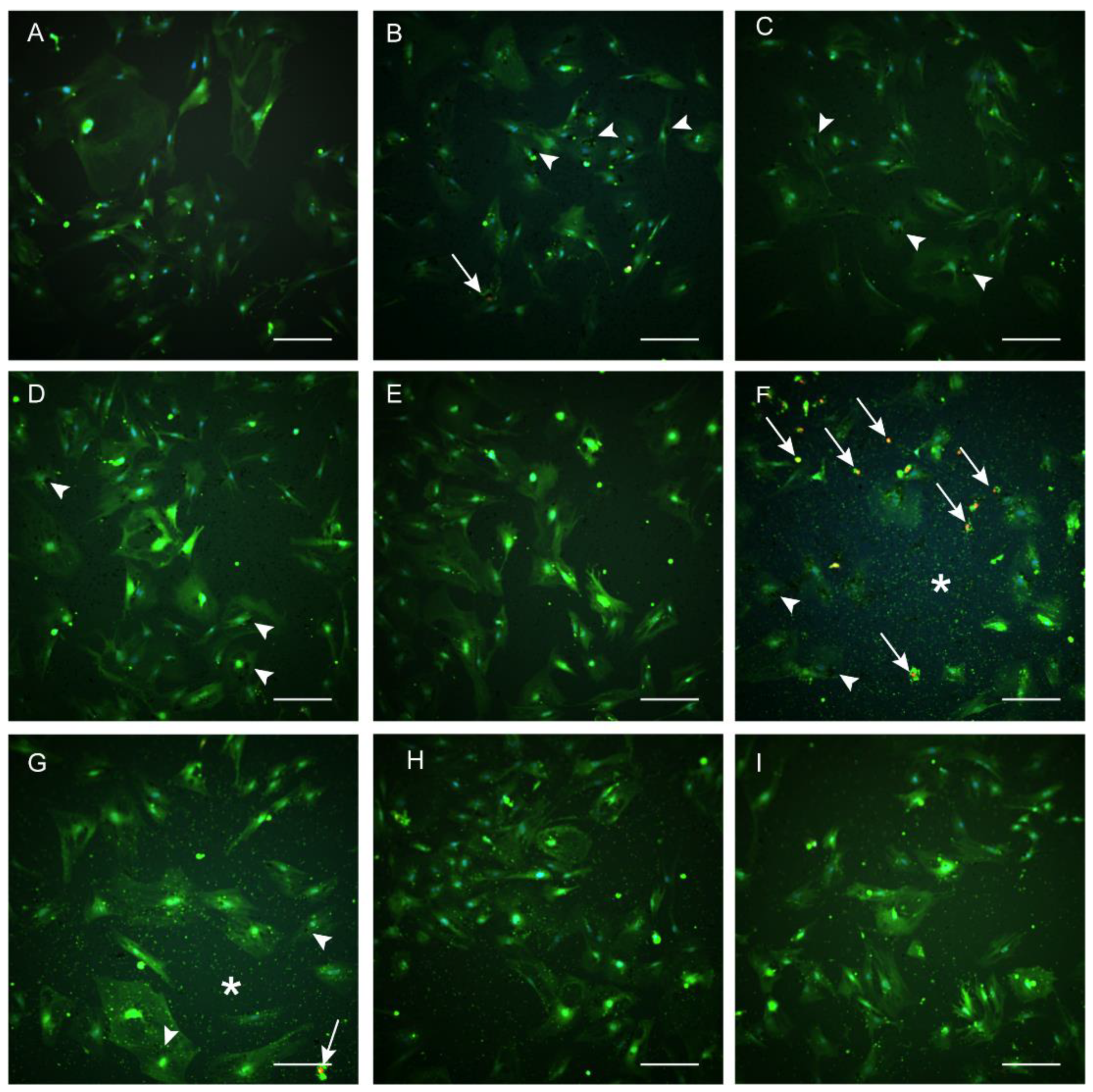 Materials 16 01034 g008 Materials 16 01034 g008