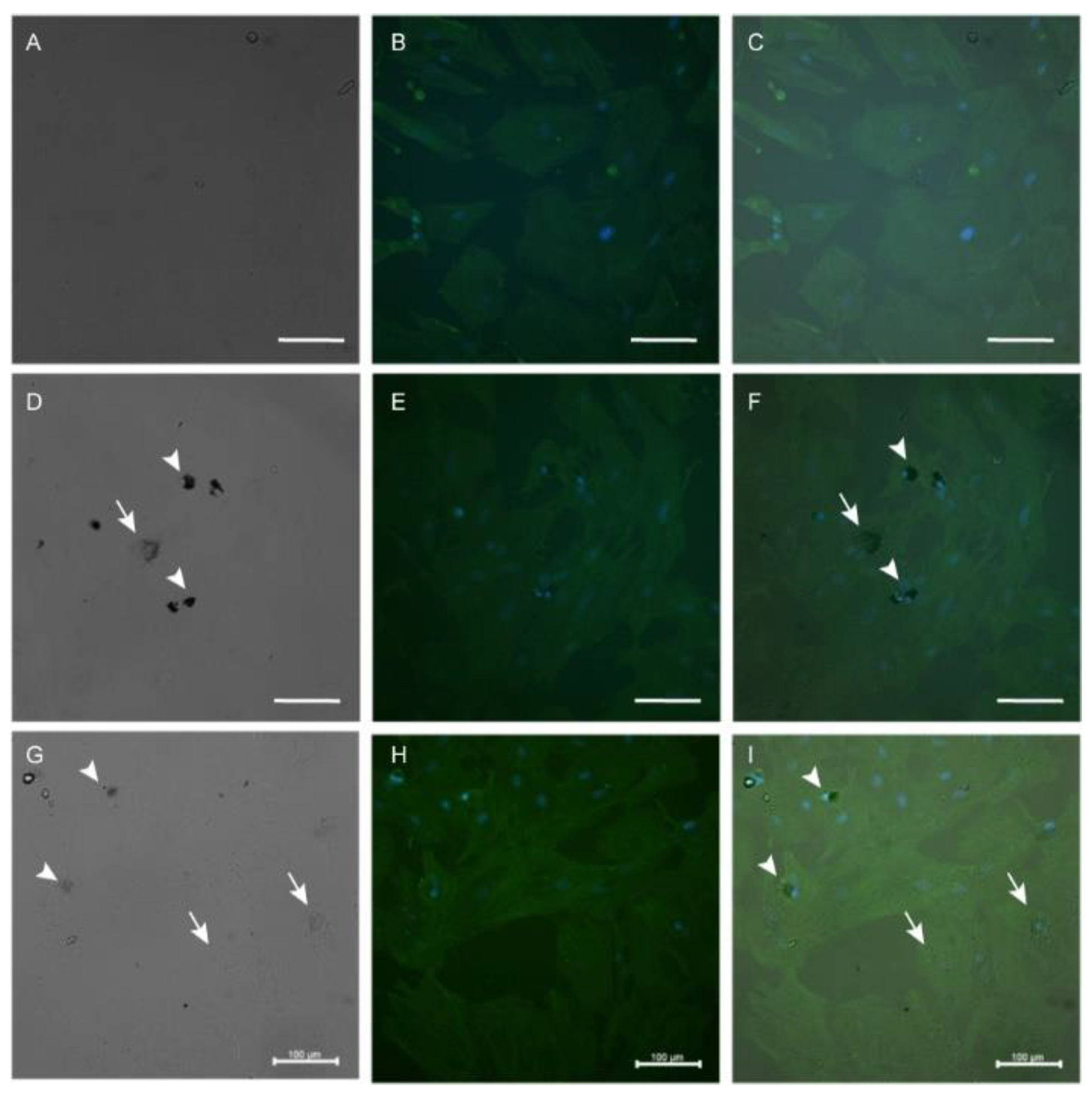 Materials 16 01034 g009 Materials 16 01034 g009