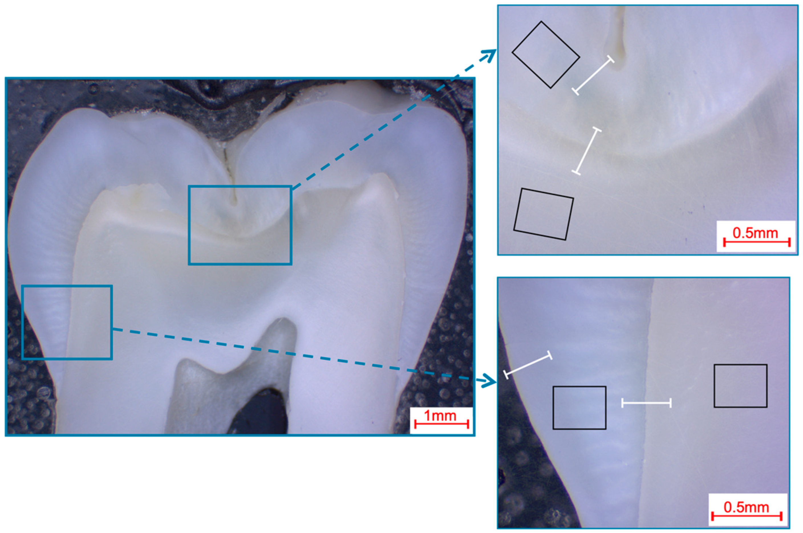 Materials 16 01514 g004