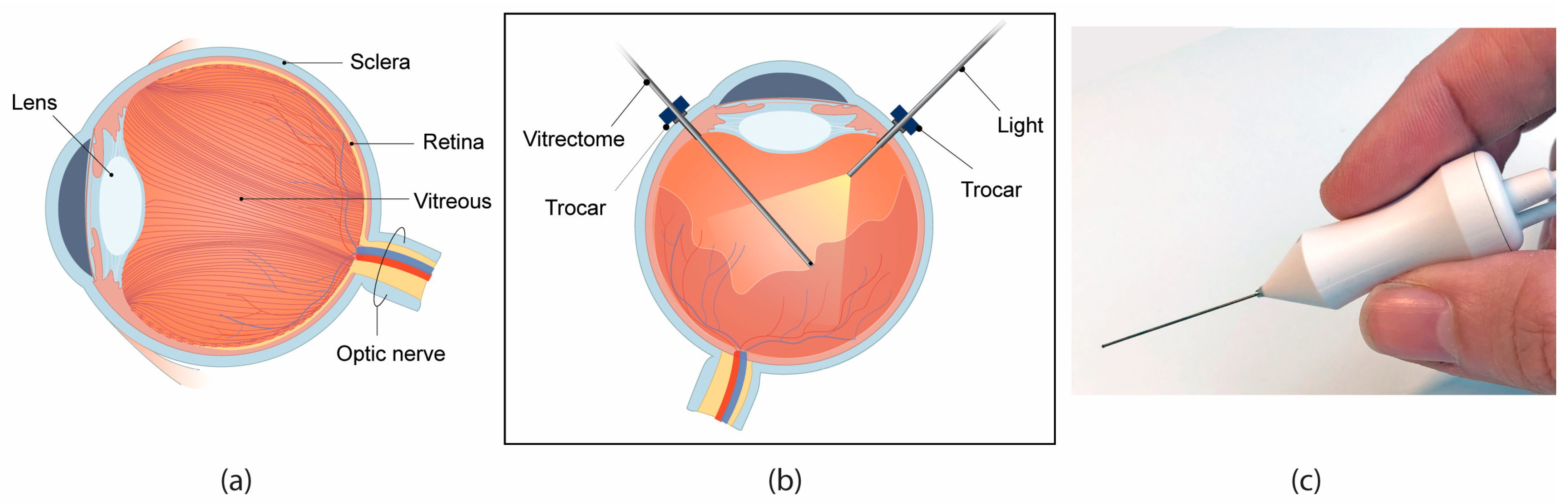 Materials 16 01772 g001