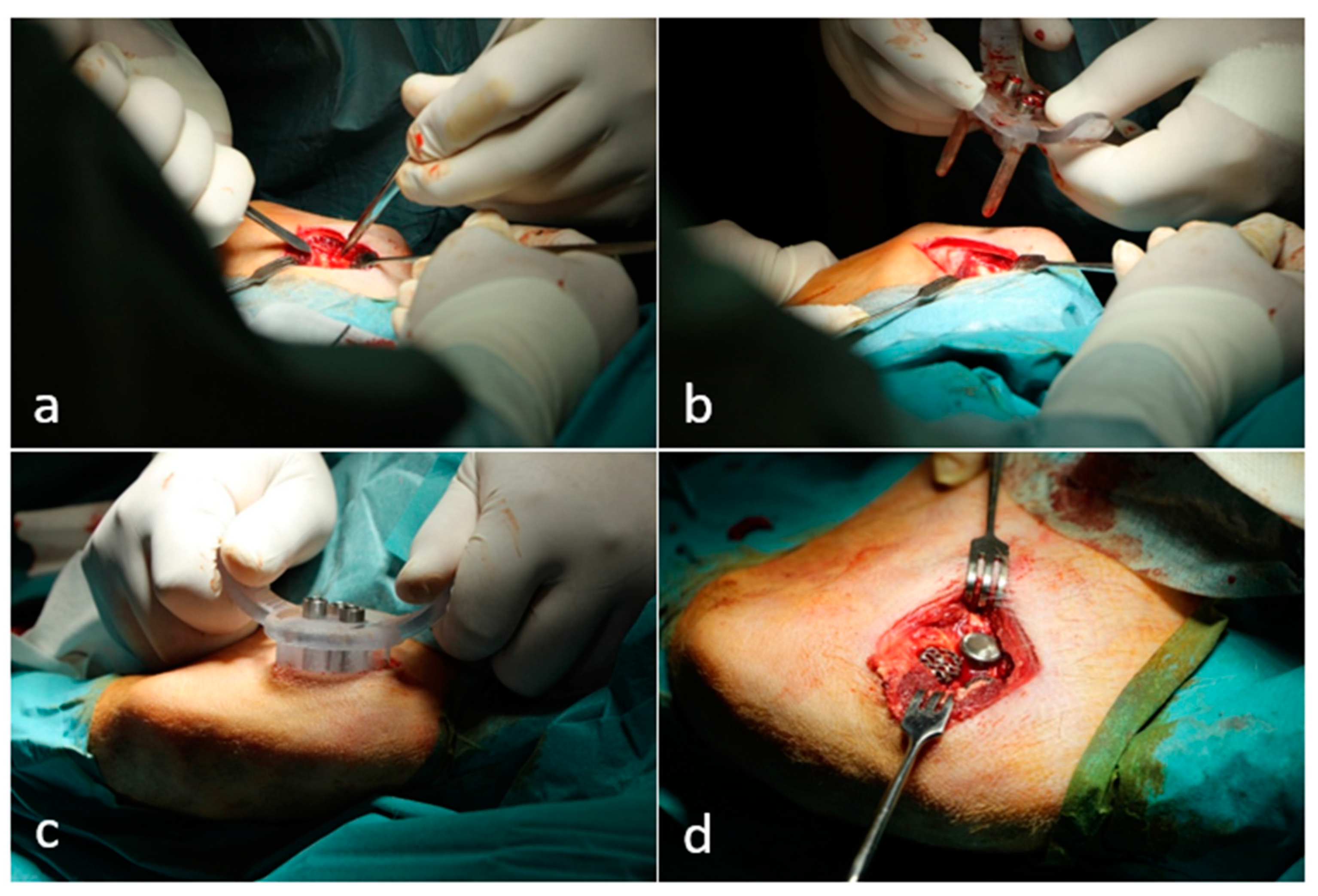 Materials 16 03861 g003